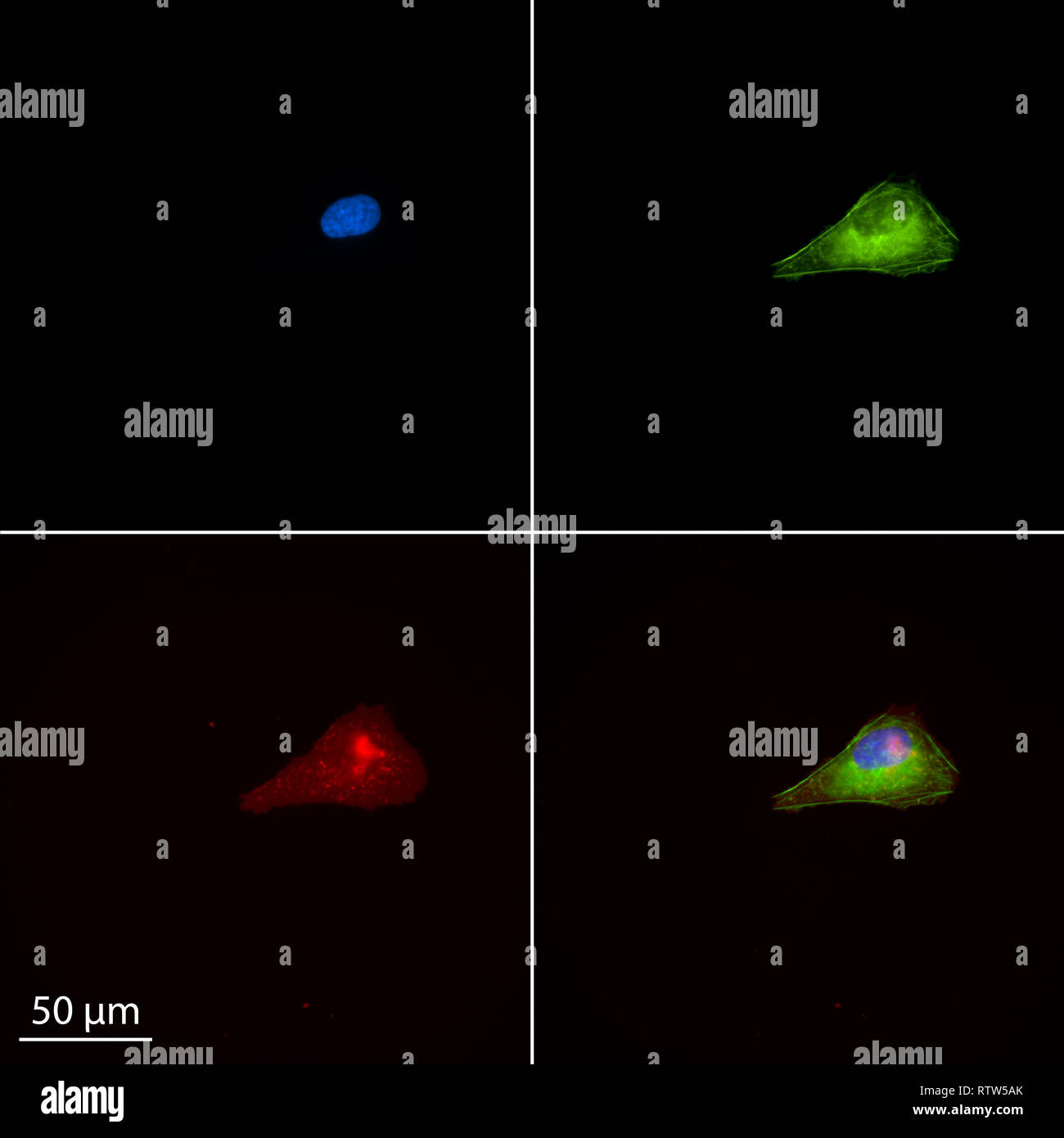 Einzelne menschliche Zelle Osteosarkom gebeizt für epifluorescence Stockfoto