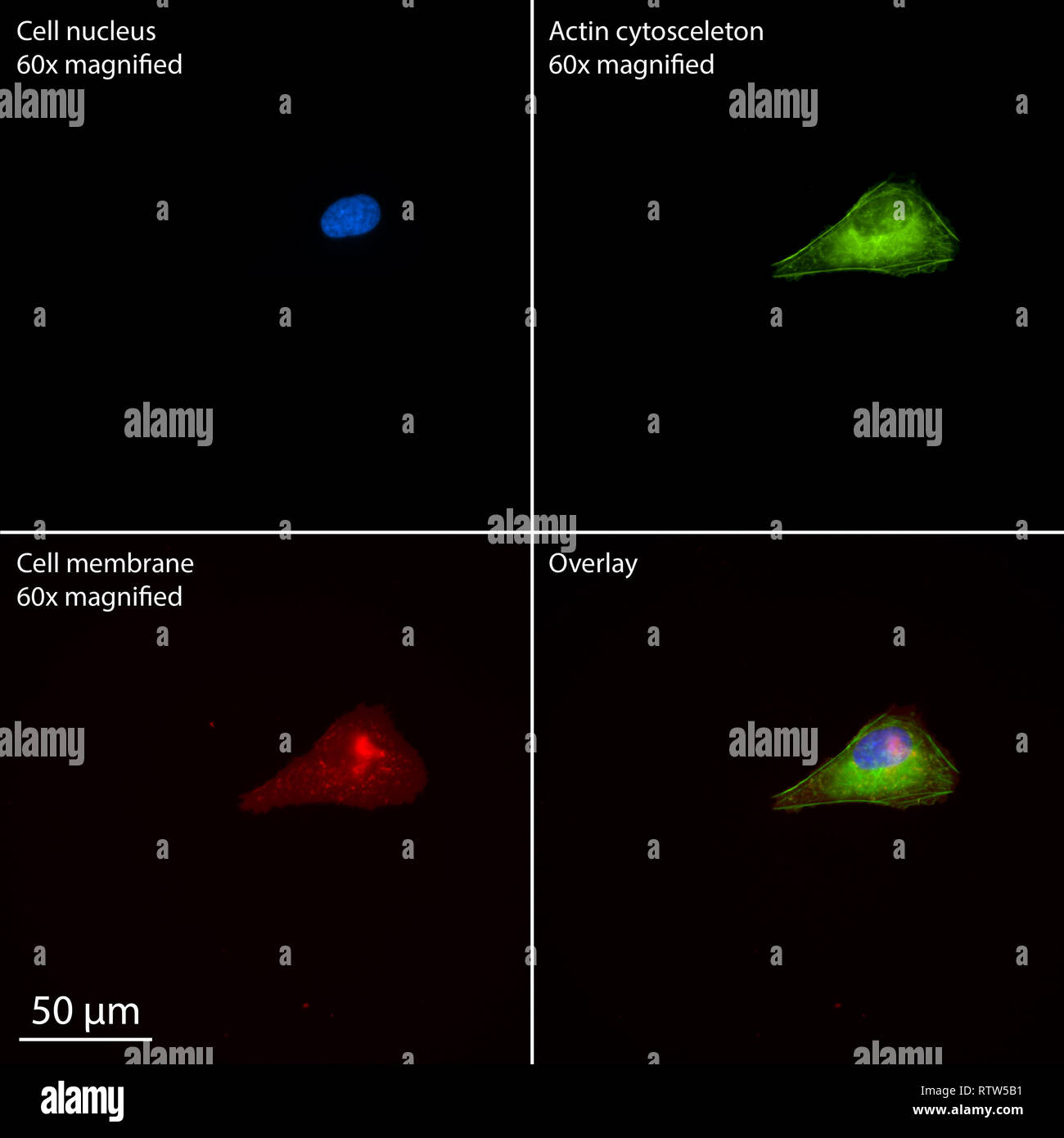Einzelne menschliche Zelle Osteosarkom gebeizt für epifluorescence Stockfoto