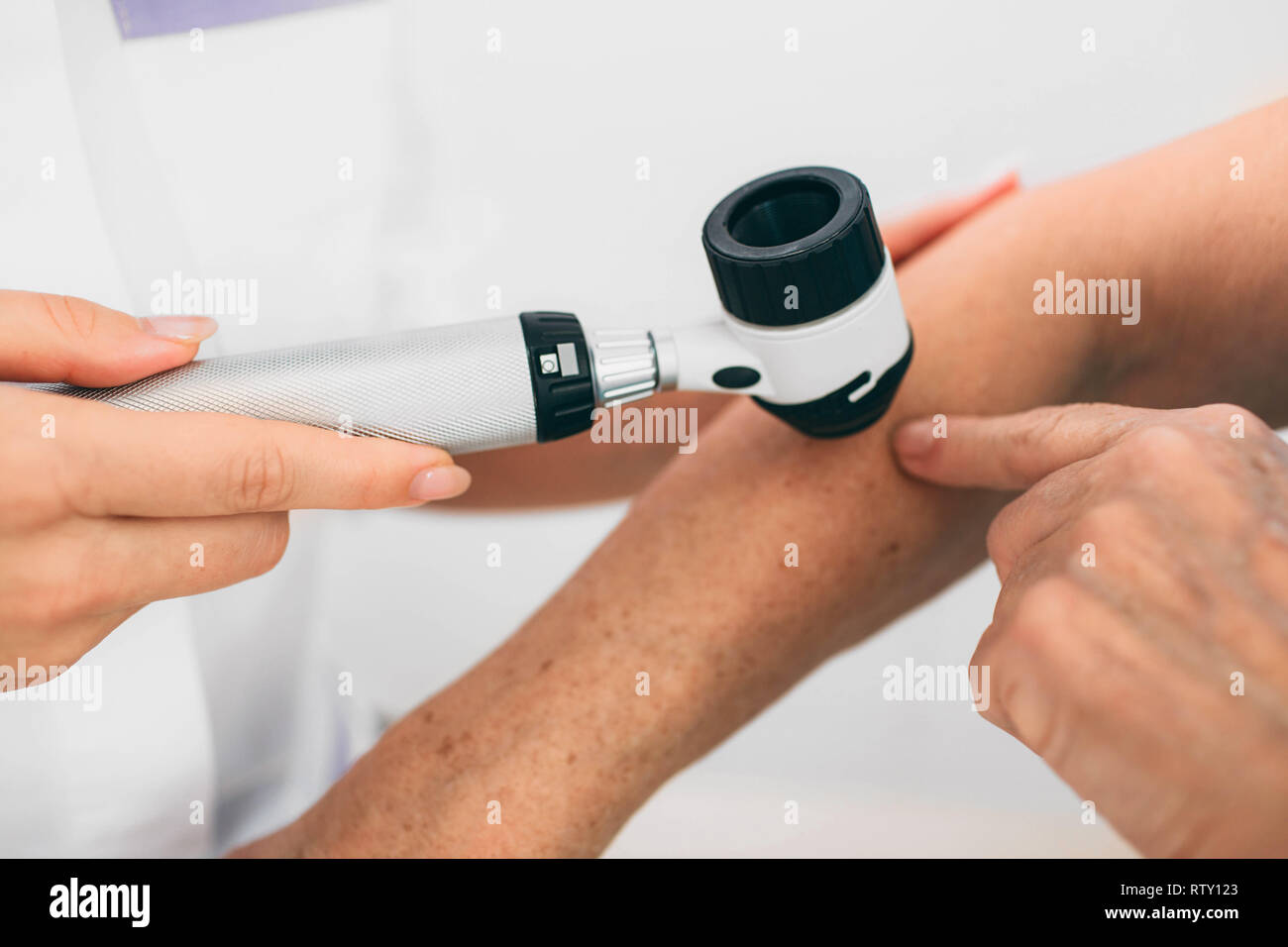 Arzt untersucht Hautmole mit Dermoskop Stockfoto