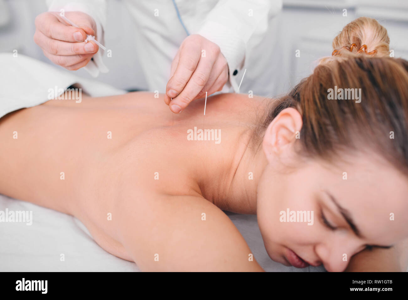 Acupuncturist Einführen einer Nadel in eine weibliche zurück. Patienten mit der traditionellen Chinesischen Behandlung mit Nadeln einen Energiefluss durch spec Wiederherstellen Stockfoto