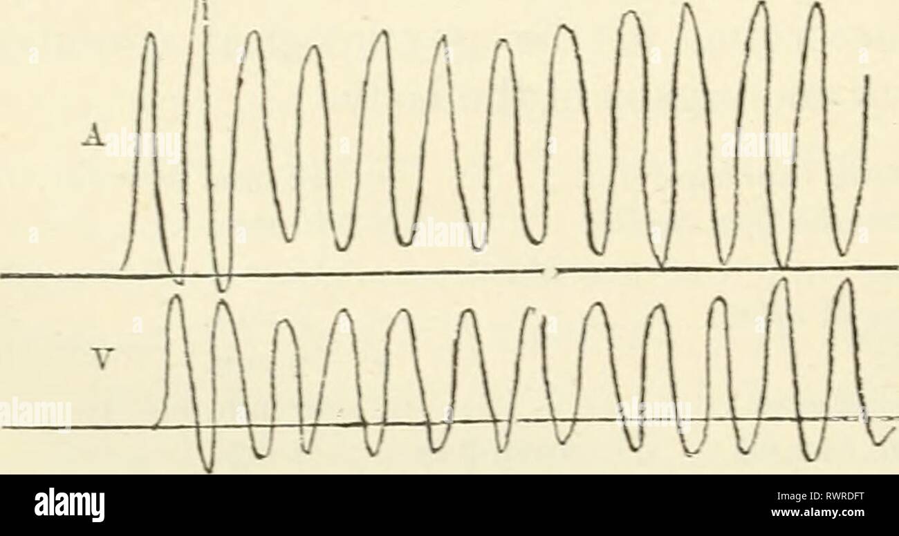 Die Elemente der menschlichen Physiologie (1907) Elemente der menschlichen Physiologie elementsofhumanp 05 Sterne Jahr: 1907 Diagramm der künstlichen Zirkulation Schema. zurück in das Becken. An Verzweigungen von (a) und (v) Zwei mercurial Manometer (m ' und m-) verbunden sind, und diese sind so angeordnet, dass sie eine unter der anderen auf den geräucherten Oberfläche einer kymograph zu schreiben. Eine weitere Route für die Flüssigkeit aus (a) bis (v) ist aflbrded durch das Rohr (c'), die Bild gespannt werden. 101. Tracing von künstlichen Schema mit leichten peripheren Widerstand (Foster), a, arterielle; v, venöse Manometer. an. Pausen sind erste Der p Stockfoto