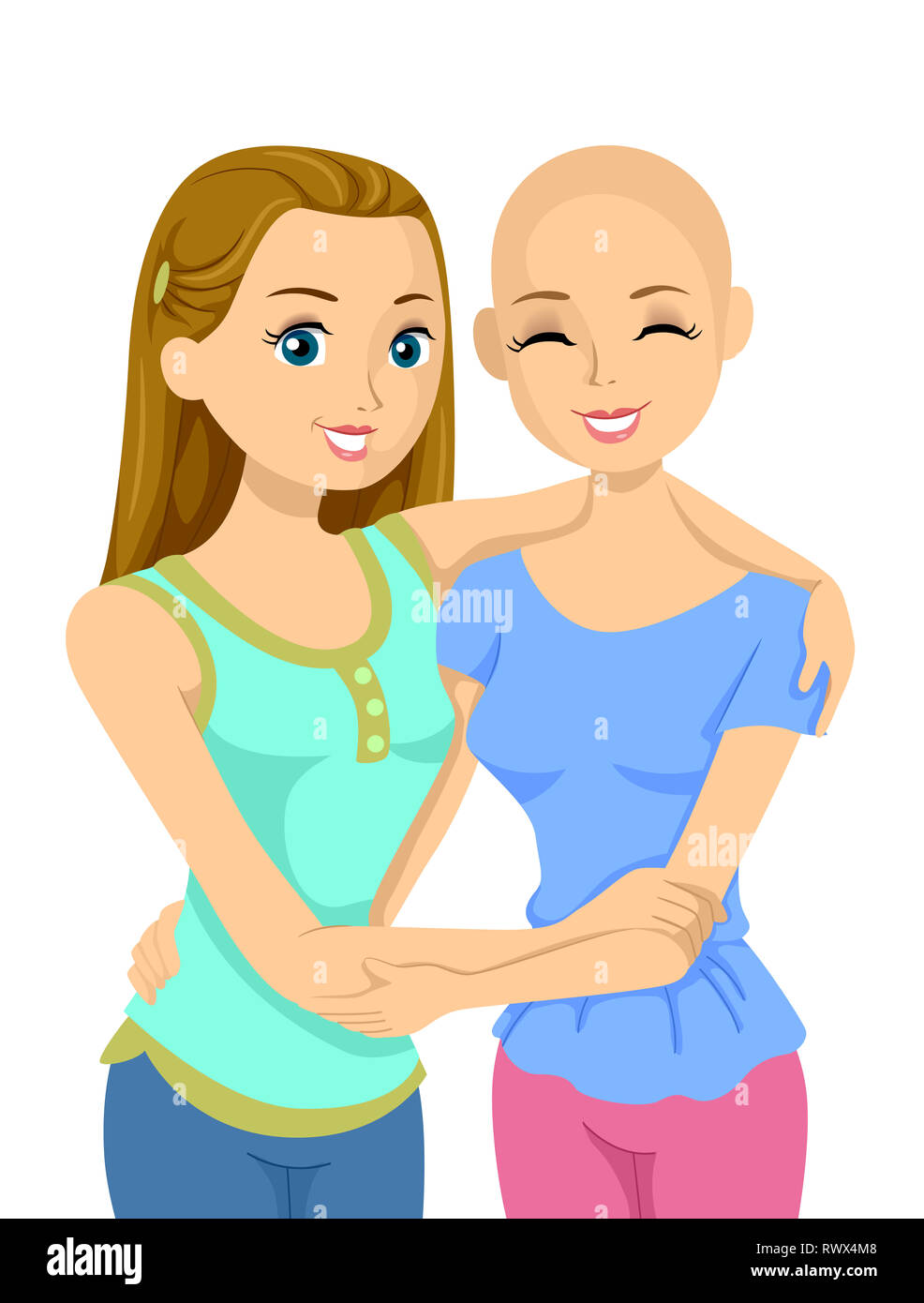 Abbildung: Junge Mädchen mit einem kahlen Mädchen leiden unter Alopezie Stockfoto