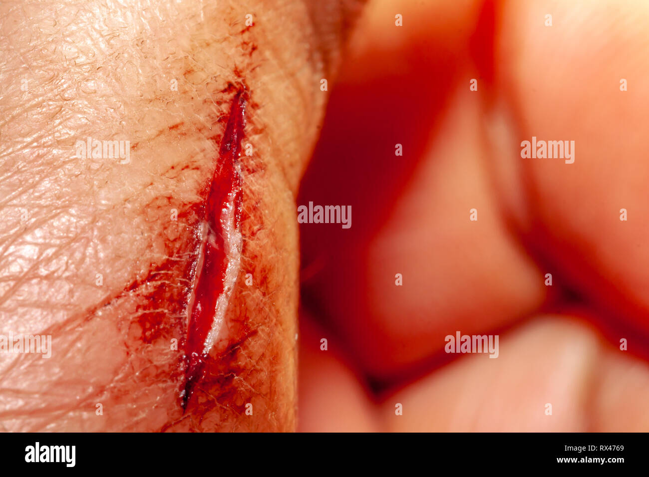 Ein Foto von einer Reihe von Fotos aufgenommen von einem frischen Blutungen schnitt Entwicklung über einen priod von 90 Minuten. Stockfoto