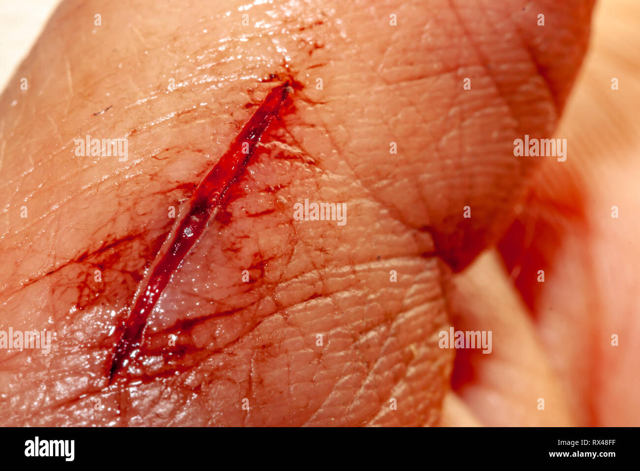 Ein Foto von einer Reihe von Fotos aufgenommen von einem frischen Blutungen schnitt Entwicklung über einen priod von 90 Minuten. Stockfoto