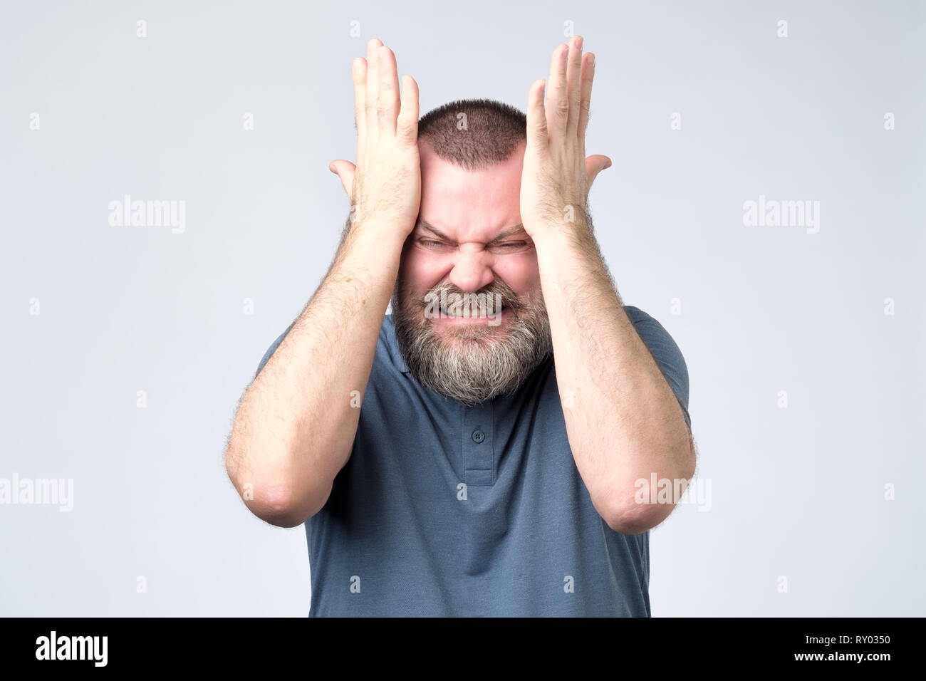 Reife bärtige Mann stehen und das Zusammenpressen Kopf aus einem Migräneanfall Stockfoto