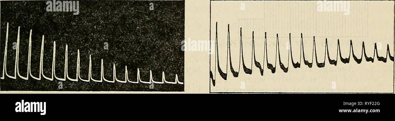 Acht Vorträge über das Lebenszeichen von Ihren elektrischen Aspekt eightlectureson 00 Wand Jahr: 1903 •] Muskel Ströme der Betrag für die Vitalität von Muskeln besaß. Eine schwache Muskeln können weniger Arbeit als eine starke Muskeln, und einen bestimmten Muskel im Laufe der Müdigkeit, oder der letzte Akt des Lebens, dass wir Tod nennen, kann weniger und weniger umfangreiche Kontraktion geben, und eine kleinere Menge an Arbeit. Mit Paripassic declin-ing Kontraktion bezeugen wir rückläufige elektromotorische Antwort, und wir zugeben oder davon ausgehen, dass die gemeinsame Substrat der abzulehnen, egal ob mechanisch oder elektrisch, ist decli Stockfoto