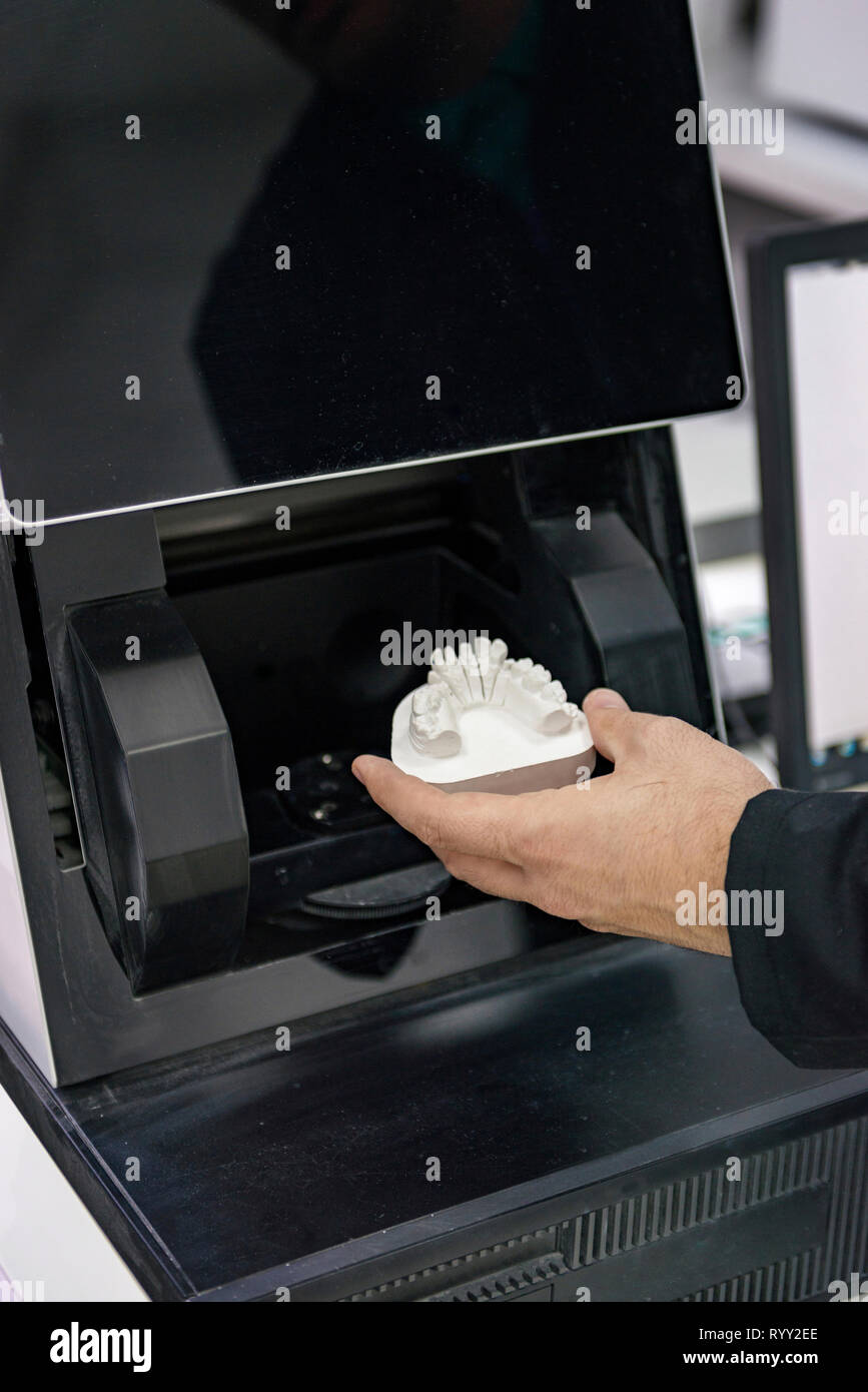Zahnmedizinische 3D-Scanner. Stockfoto