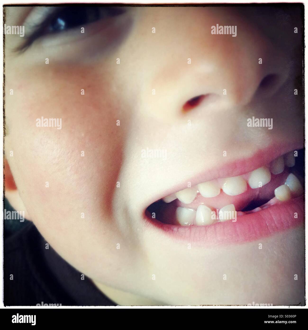 Kind fehlt die beiden unteren Zähnen, Nahaufnahme der Mund des jungen zeigen seine beiden unteren Zähne fehlen Stockfoto