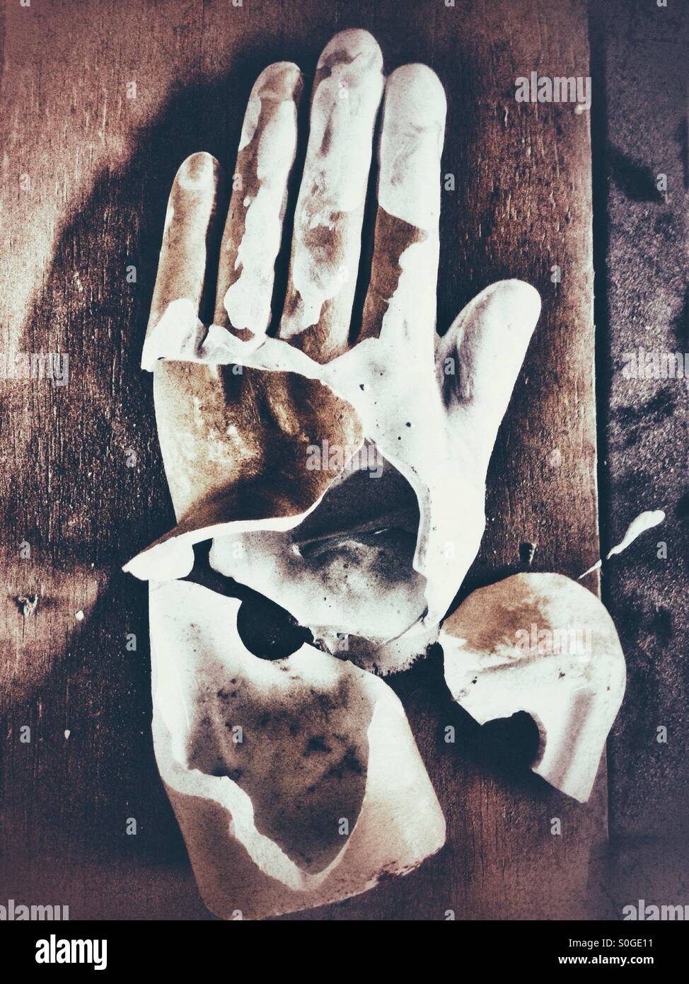 Gebrochenen Hand Stockfoto Gebrochenen Hand Stockfoto