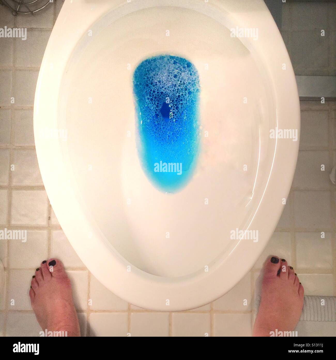 Ein Bild von einer Toilettenschüssel mit blauer Flüssigkeit darin mit dem Fotografen Füße zeigen auf dem Foto Stockfoto