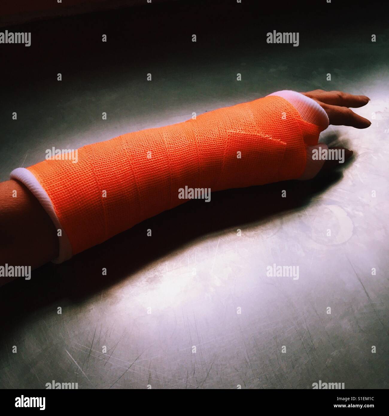 Ein Bild von einer weiblichen Unterarm in eine Orange auf einer Metalloberfläche gegossen. Stockfoto