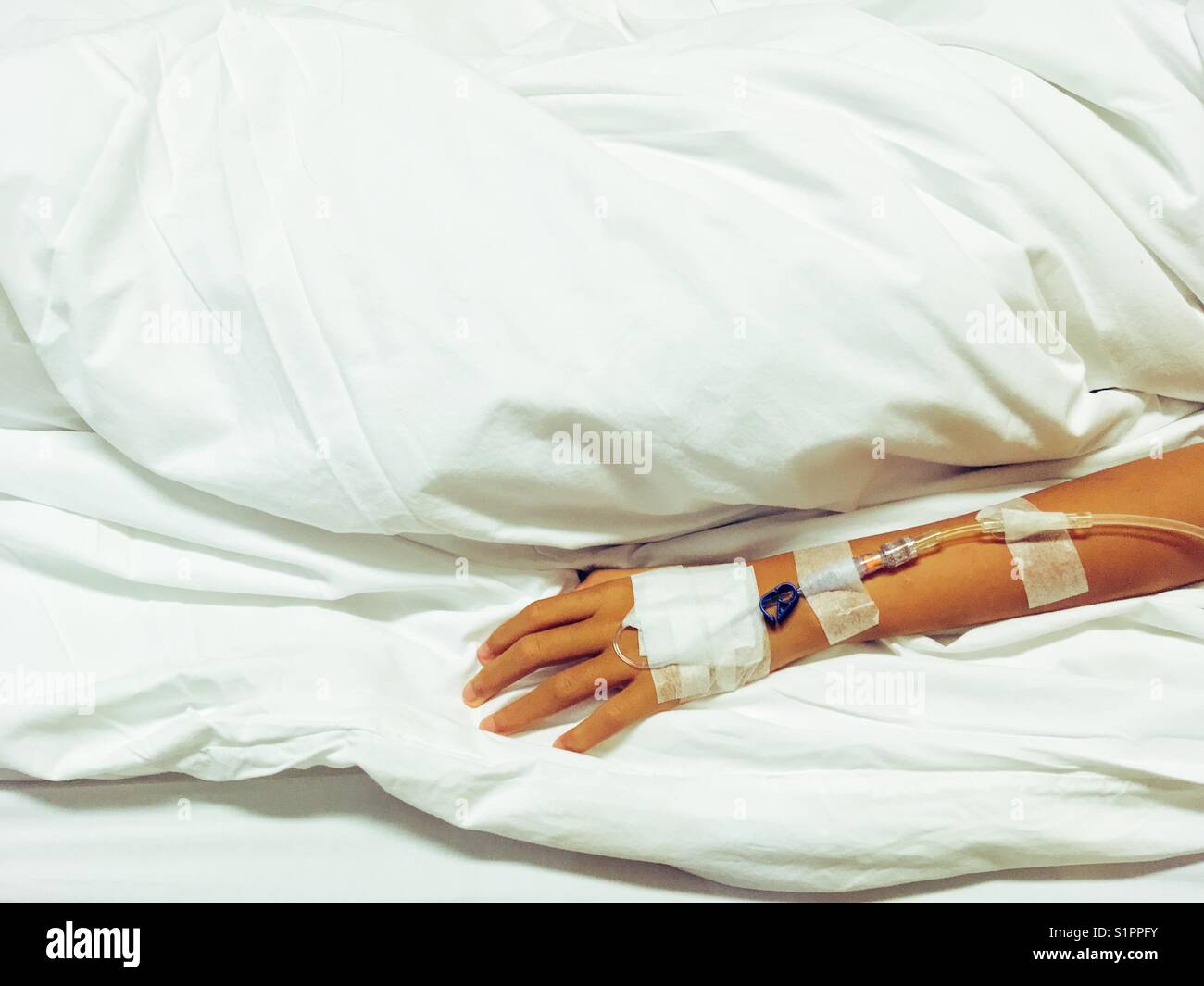 Arm des kleinen asiatischen Mädchen mit Einspritzung von Medizin drop Counter im Krankenhaus Zimmer auf dem Bett Stockfoto