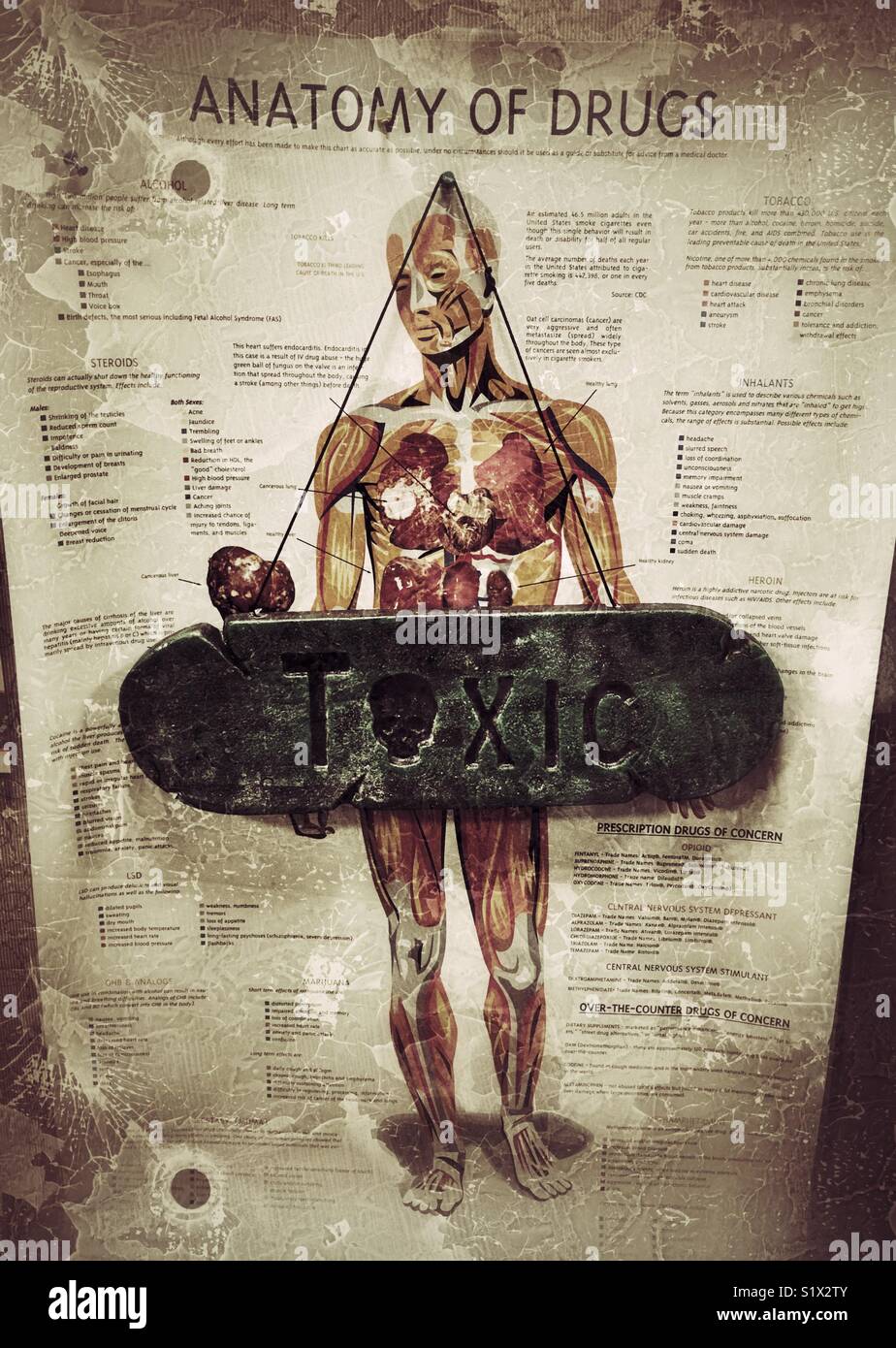 "Anatomie der Drogen" Plakat mit einem "GIFTIG" Zeichen über den Körper Stockfoto