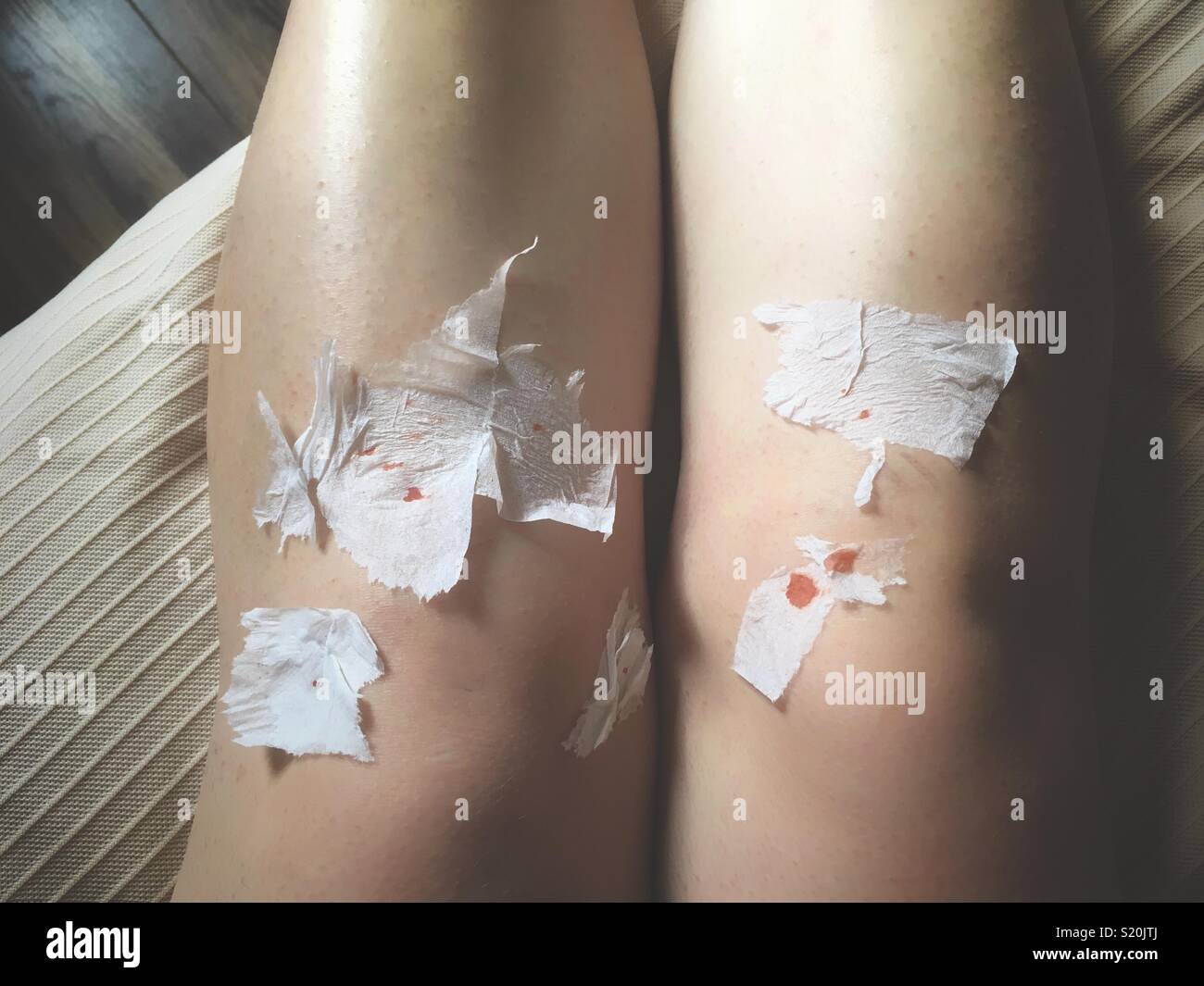 Sicht der Schuß eines weiblichen Beine nach der Rasur mit Papier von Patches auf ein Rasiermesser schneidet. Konzept - Schönheit braucht Opfer. Stockfoto