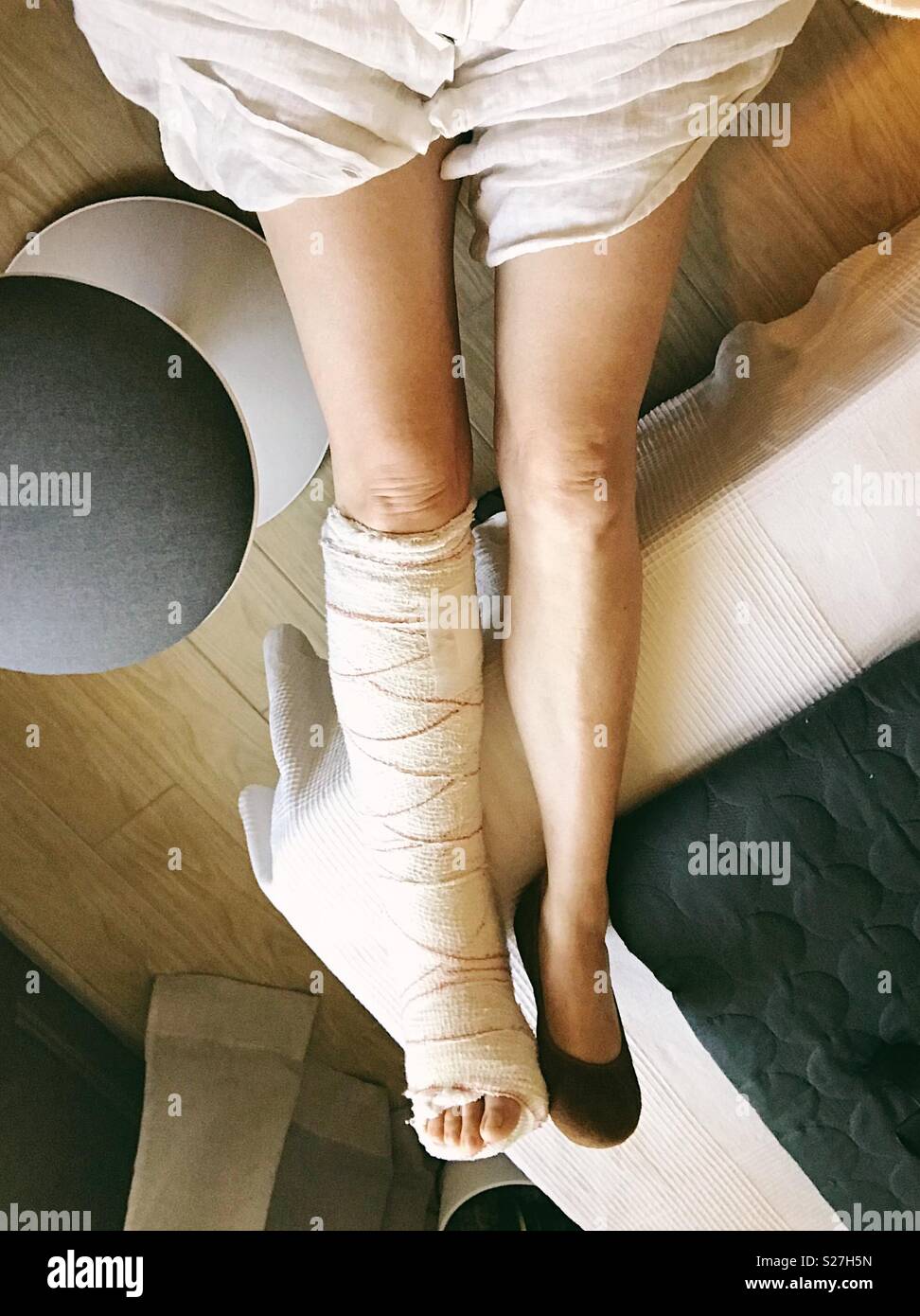 Beine brechen gegossen