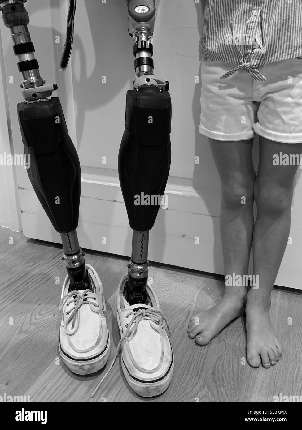 Realität der Behinderung. Die Beine meines Schwiegersohns und meiner Enkelin in schwarz-weiß Stockfoto