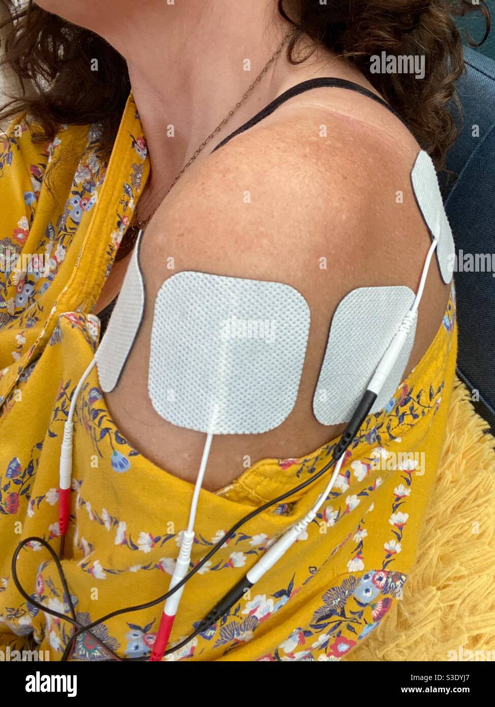 Eine Frau, die transkutane elektrische Nervenstimulation bei einer Schulterverletzung verwendet. Stockfoto