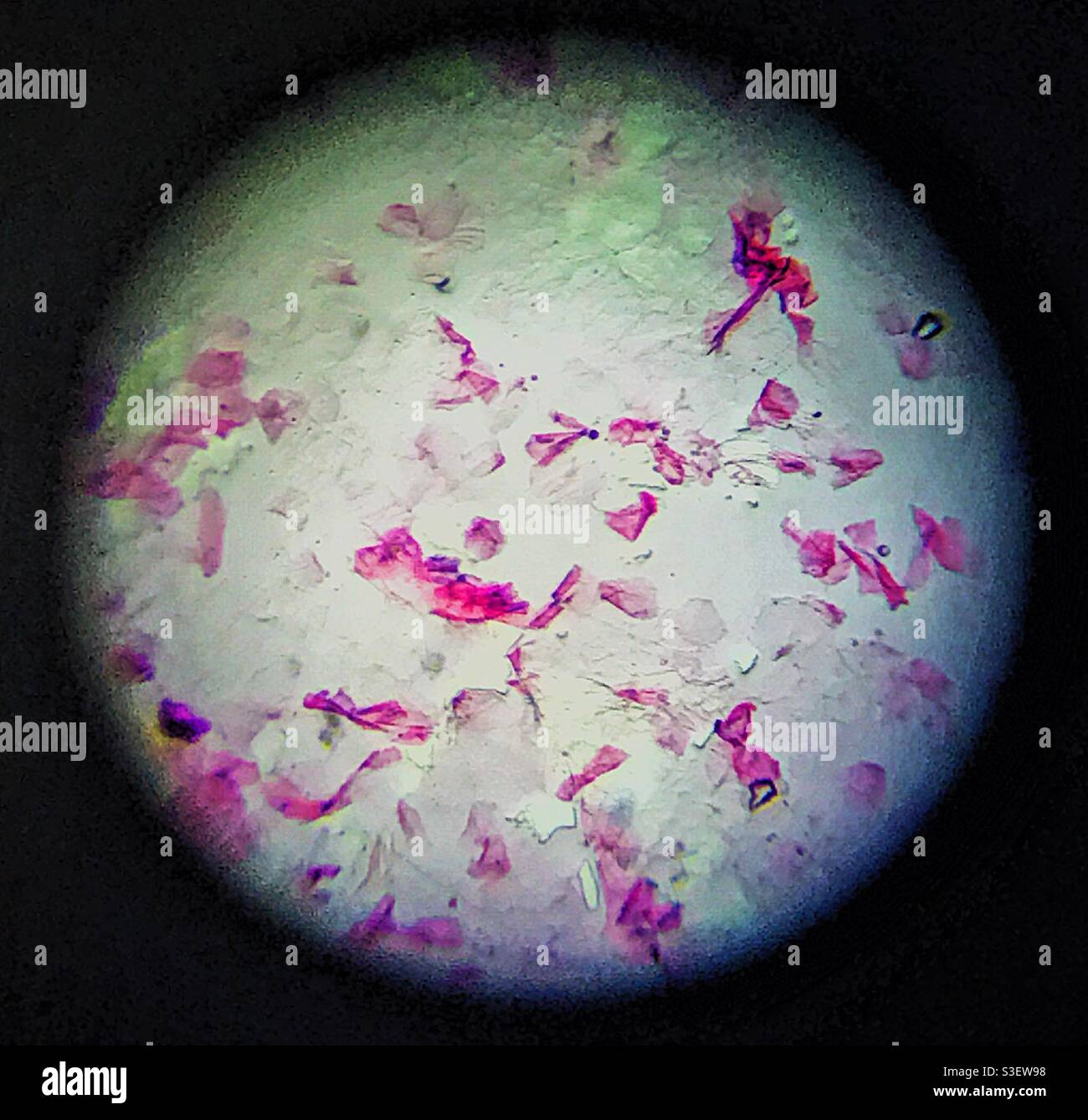 Lila und rosa Spezifikationen auf weißem Hintergrund mit kreisförmigem Schwarz Rand (Hautzellen unter dem Mikroskop) Stockfoto