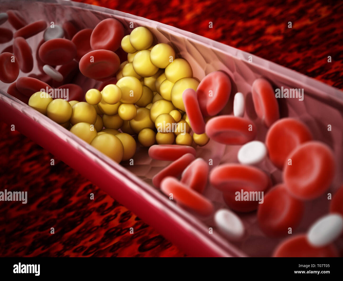 Fettzellen blockiert den Blutfluss innerhalb der menschlichen Sinne. 3D-Darstellung. Stockfoto