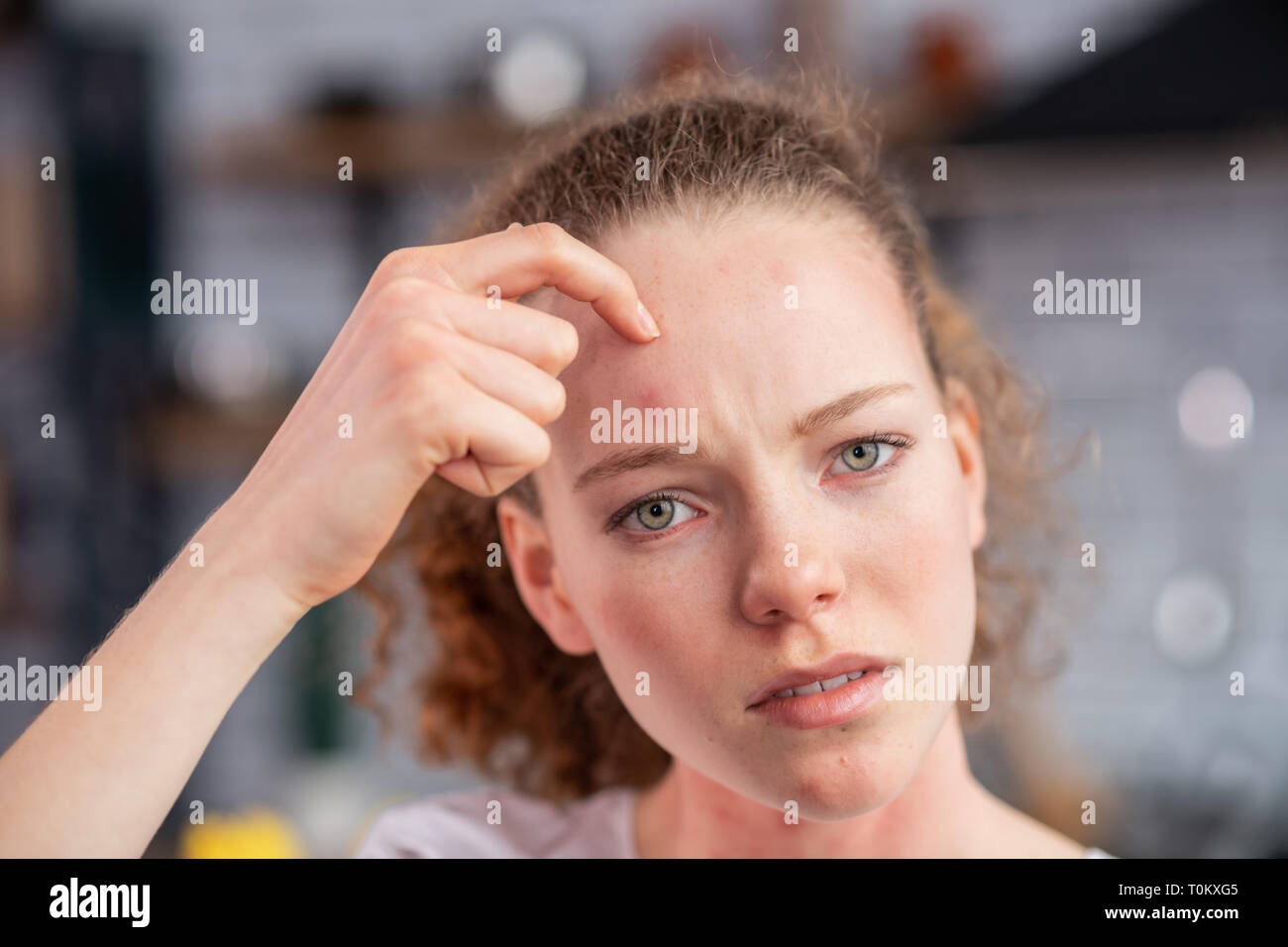 Langhaarige Frau zeigt auf allergische spot Distressed Stockfoto