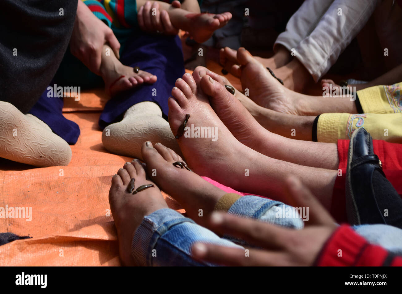 März 21, 2019-kaschmirischen Volkes nehmen Blutegel Behandlung am Dal Lake Srinagar, Indien verwalteten Kaschmir am 21. März 2019. Die traditionelle Behandlung wird jedes Jahr am Tag der Nauroz Tag (Iranische auf das Neue Jahr gehalten). Die Heiler mit Blutegel das Unreine Blut von Patienten, die Haut, kalt oder Frost Krankheiten zu saugen. (Bild: © Muzamil Mattoo/IMAGESLIVE über ZUMA Draht) Stockfoto