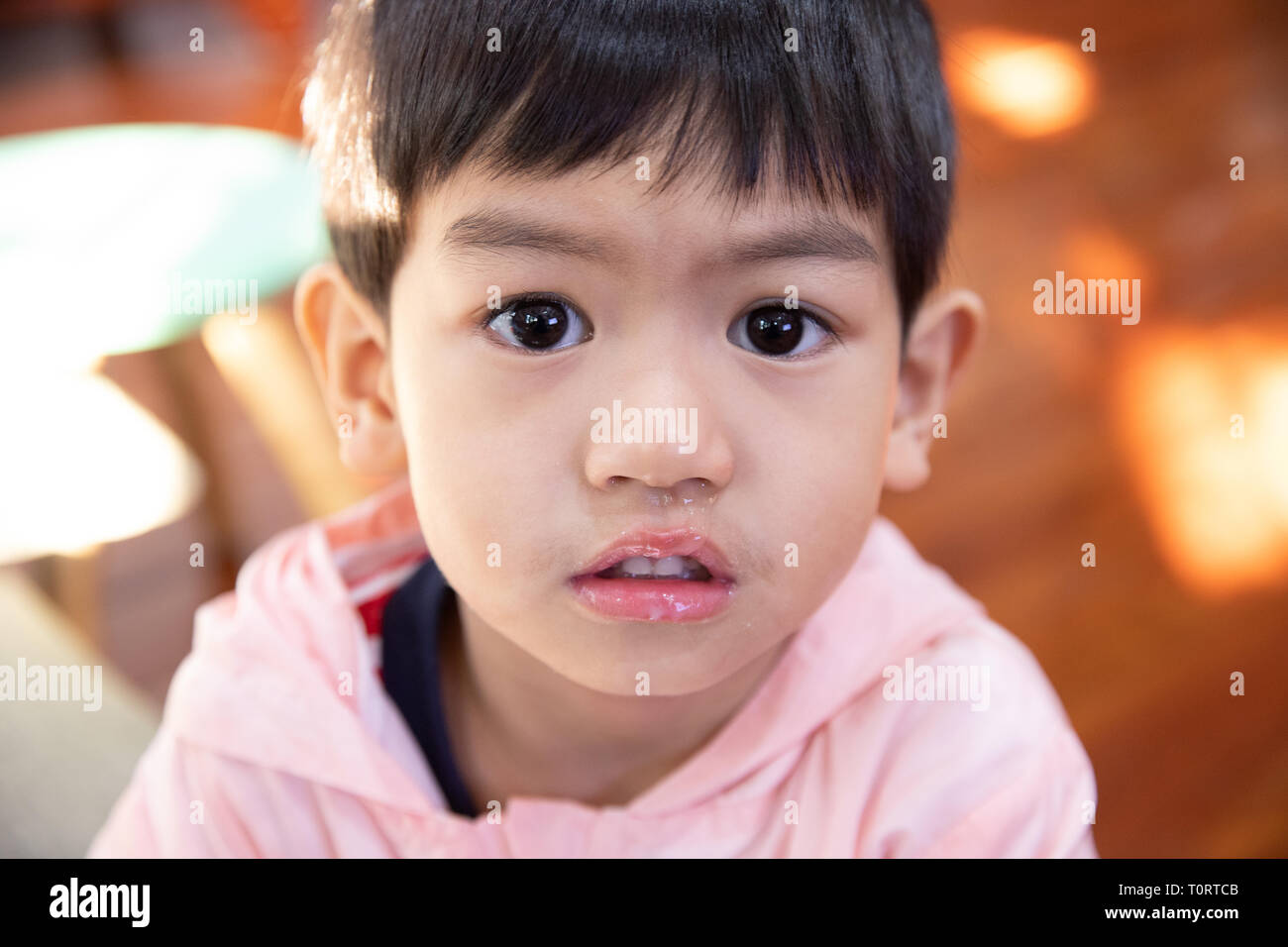 Nahaufnahme der Schleim aus der Nase, asiatische Junge hat eine laufende  Nase mit klaren Rotze Stockfotografie - Alamy