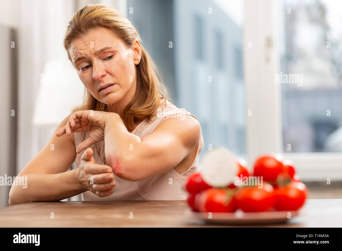Reife Frau mit empfindlicher Haut, Allergie gegen bestimmte Lebensmittel Stockfoto