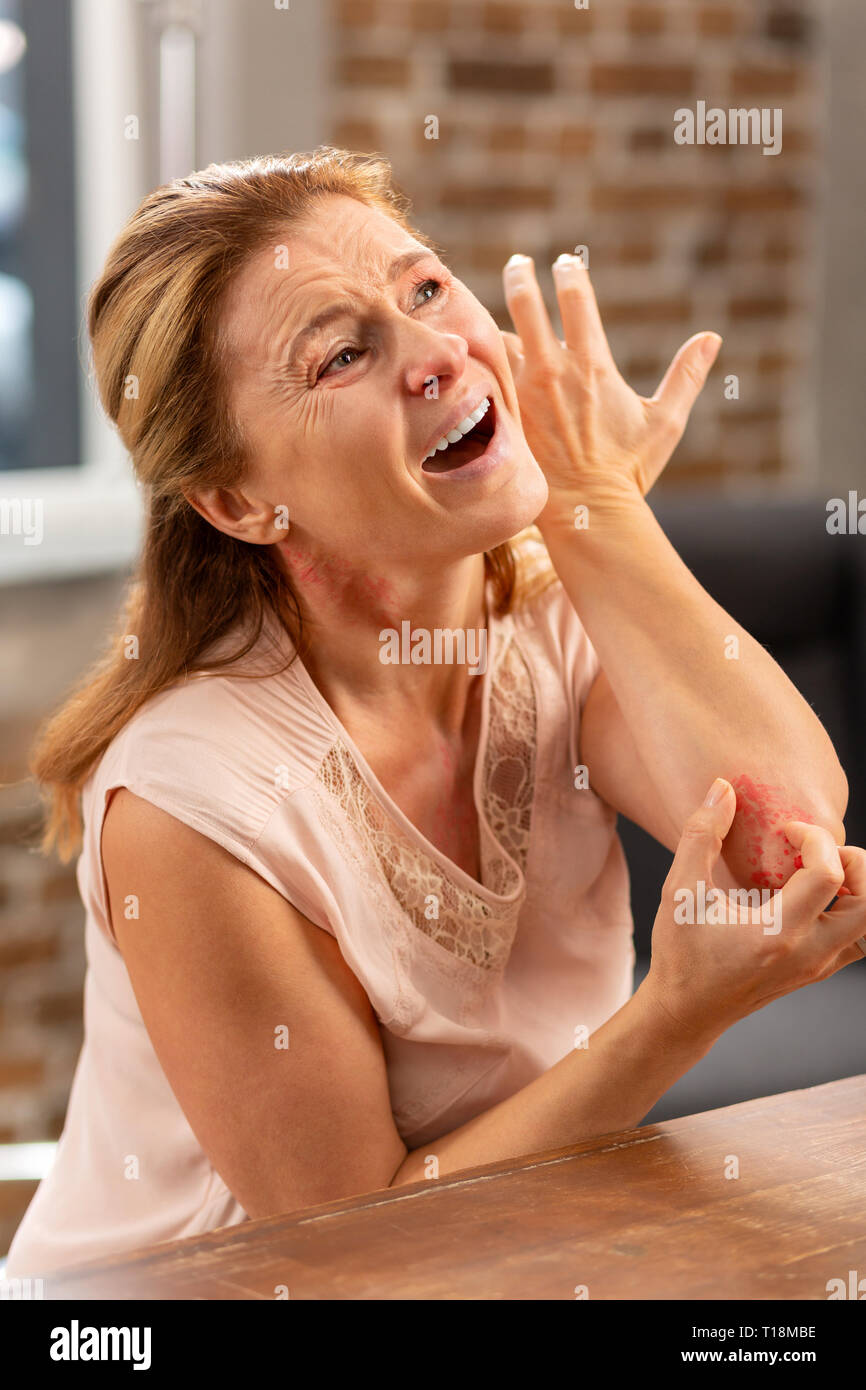 Reife Frau ihr Ellenbogen kratzen Weil allergischer Hautausschlag Stockfoto