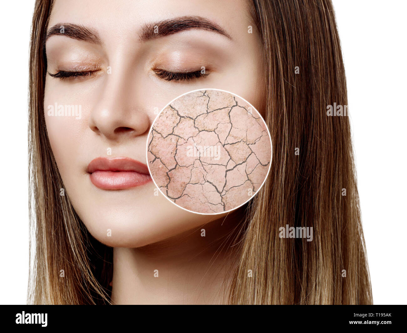 Zoom Kreis zeigt trockene Gesichtshaut vor befeuchten. Stockfoto