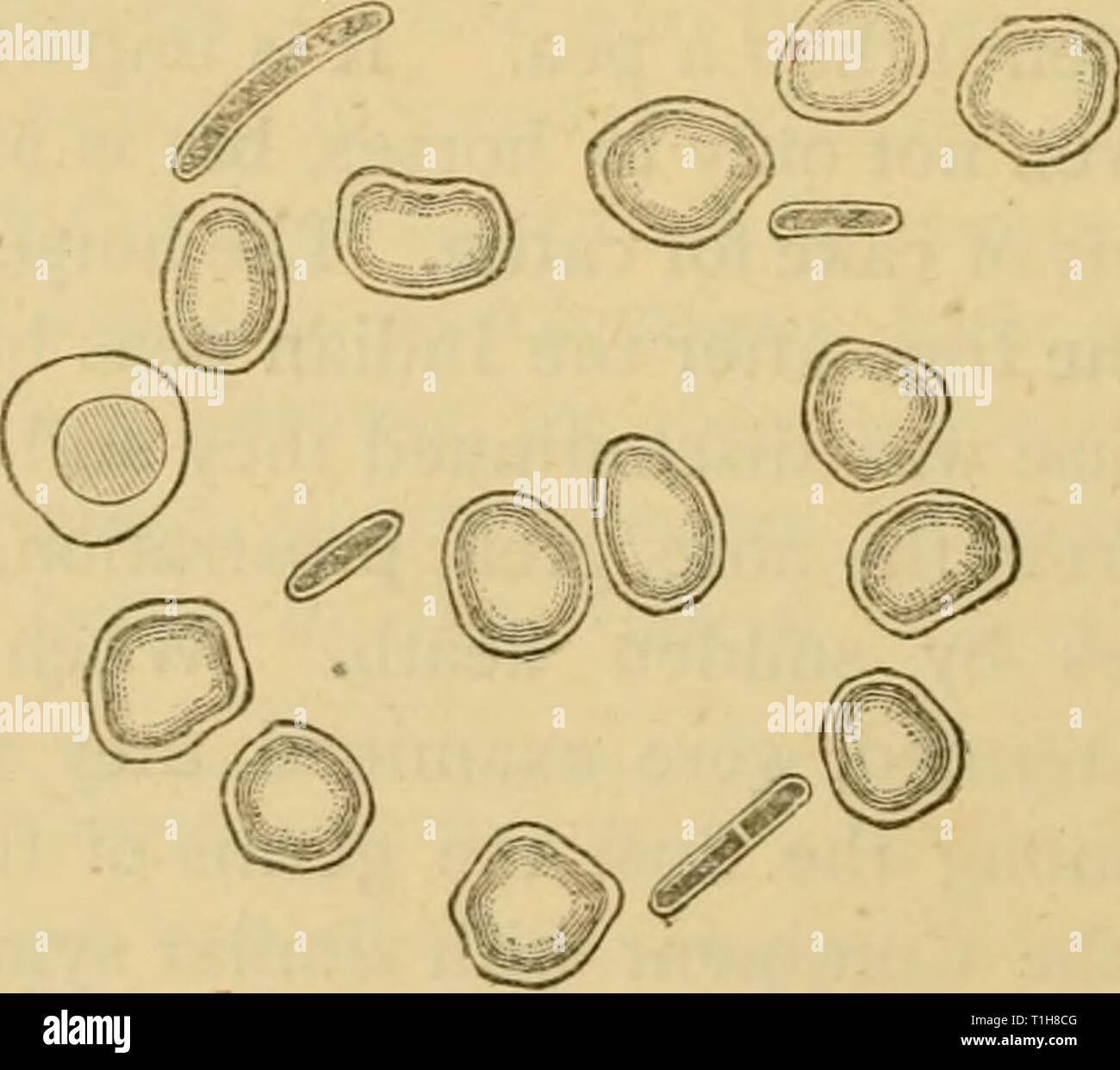 Krankheiten & Störungen der Krankheiten & Beschwerden des Pferdes: Eine Abhandlung über equine Medizin und Chirurgie diseasesdisorder 00 gres Jahr: 1886 Herz Blut eines toten jMouse von Milzbrand. 1. Blut - Discs. "2. "Hite Blut - korpuskel. 3. Bazillen anthracis. INIagnifying Power 700. (Frisches Exemplar.) nach Klein. Blut eines Guinea-pig Tot der symptomatischen Anthrax. Blut - blutkörperchen und zwischen ihnen mehrere Bazillen. Ingnifying Power 700. (Gefärbt mit Spiller's Lila.) nach Klein. Stockfoto