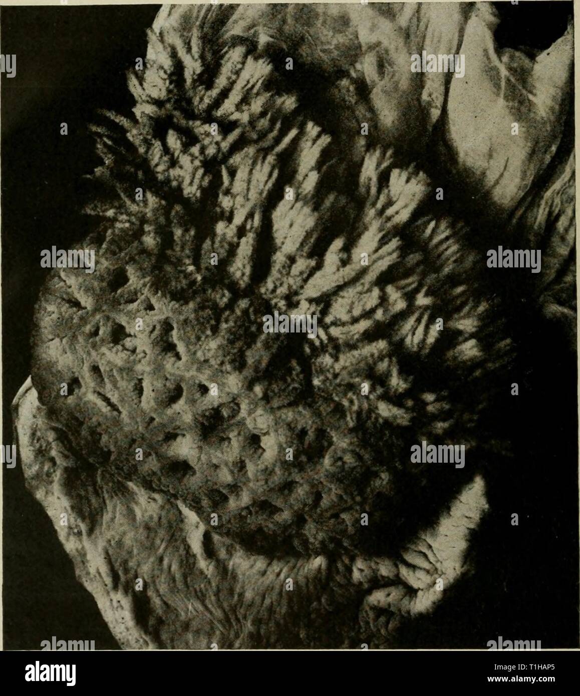 Uterine Cavity Stockfotos Und Bilder Kaufen Alamy