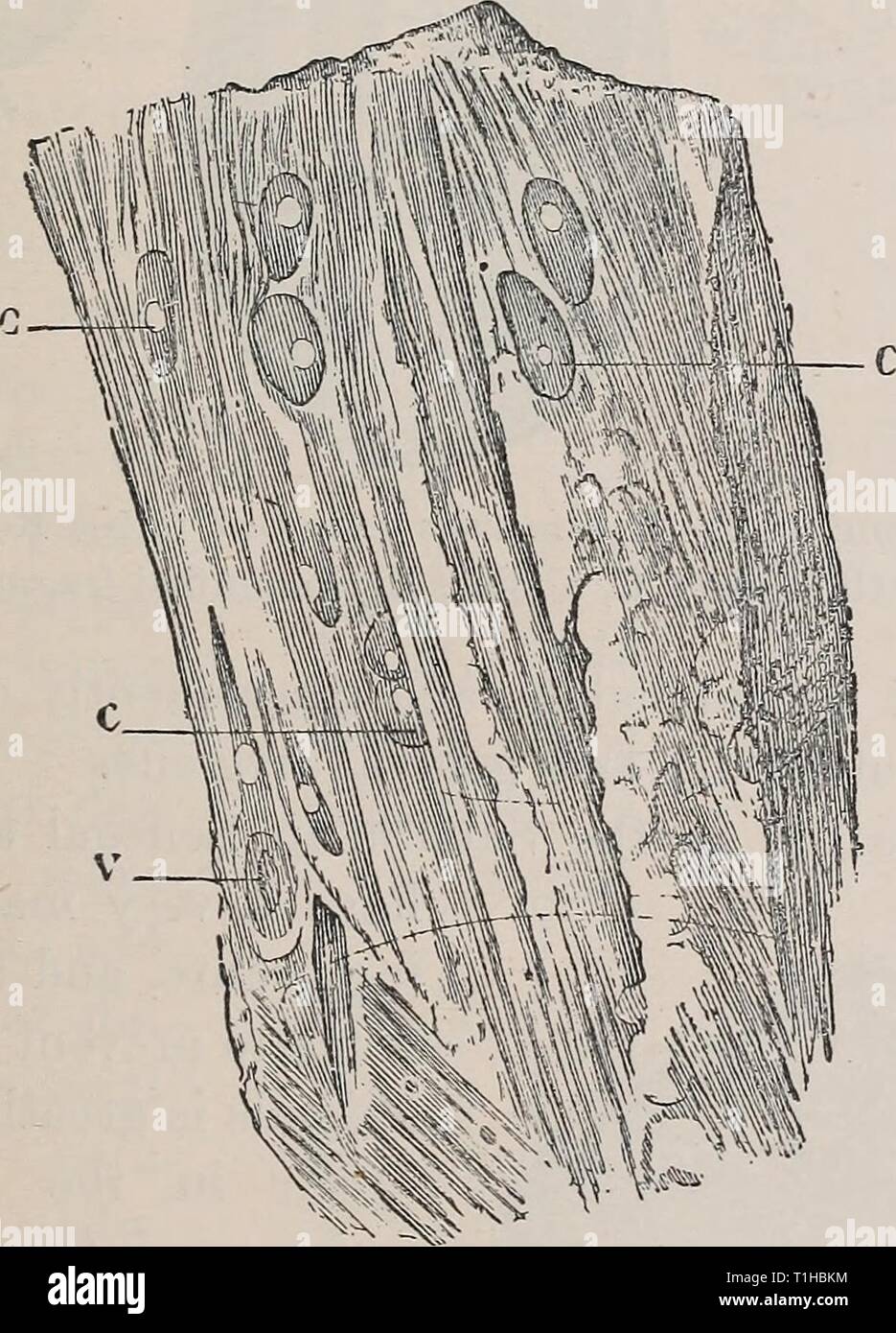 Erkrankungen der Rinder, Schafe, Ziegen Krankheiten von Rindern, Schafen, Ziegen und Schweinen diseasesofcattl 00 mous Jahr: 1905 RINDFLEISCH MASERN. ? 9 wert. Diese sind, was es für die Tiere unmöglich, Eier der 2 enia solium Ingest beschränkt. Cjsticercus Krankheit ist selten im Norden, in der Mitte und im Osten von Frankreich, und in den Bezirken vhere Tiere in Gefangenschaft aufgezogen werden. Es ist einfacher Bürger, wo Schweine frei sind, wie z.b. Limousin, Auvergne, Perigord. Es ist häufig in Norddeutschland, wo die Gewohnheit des Essens der Halb gekocht Fleisch trägt dazu bei, die Ausbreitung von Tcenia solium. Es ist auch häufig es Italien. Werden Stockfoto