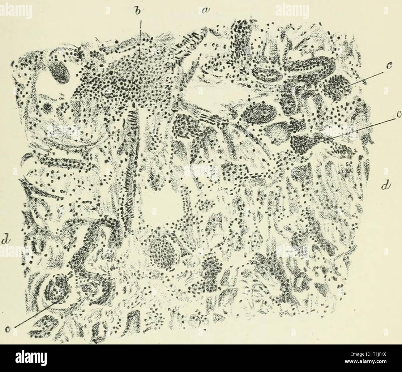 Die Krankheiten und Störungen der Krankheiten und Störungen des Ochsen, mit Berücksichtigung der Krankheiten der Schafe diseasesdisorderox 00 gres Jahr: 1889 I'LAltL l. MICEOCOCCUS SCAELATIN. E. Schnitt durch die Niere einer Maus experimentell infizierten mit Micrococcus Scarlatina, abgeleitet von einer besonders "Jlar Marke von Kondensmilch - Ein interlobular kortikalen Arterie. b Extravasation und Massen von runden Zellen. c Malpighian Blutkörperchen; verstopft und Anzahl der Kerne viel erhöht ((jlomerulo - Nephritis). d Unorganisiert gewundenen Tubuli. I.. Rr. nf iinvt> r 100 Stockfoto