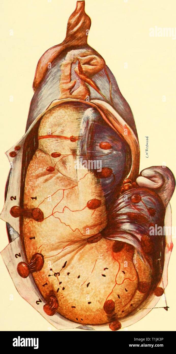 Erkrankungen Des Genitale Die Krankheiten Der Geschlechtsorgane Von Haustieren Diseasesofgenita 00 Jahr 1921 S S C T3 Gt 2 W H Lt D E W Clh O X U Fa C S Co 4 1 U Ct