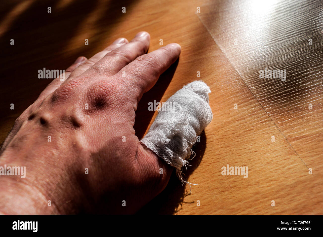 Die Hand eines weißen kaukasischen Mann mit seinem verletzten Finger mit einem weißen Verband gebunden. Stockfoto