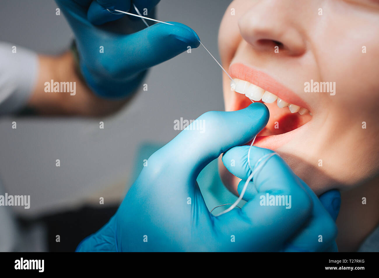 Schnitt Ansicht schließen sich junge weibliche Client in der Zahnheilkunde. Arzt mit Zahnseide für die Reinigung zwischen den Zähnen. Frau Mund öffnete. Sie zeigen schöne Stockfoto