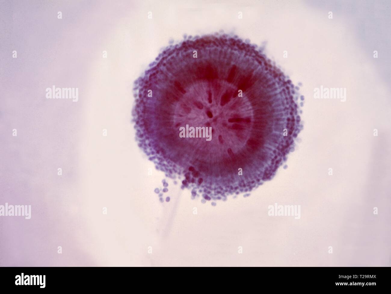 Conidial Photomicrograph der Kopf eines Pilzes Aspergillus niger, die eine doppelte Reihe von sterigmata, 1955. Bild mit freundlicher Genehmigung Zentren für Krankheitskontrolle und Prävention (CDC)/Dr Lucille K. Georg. () Stockfoto