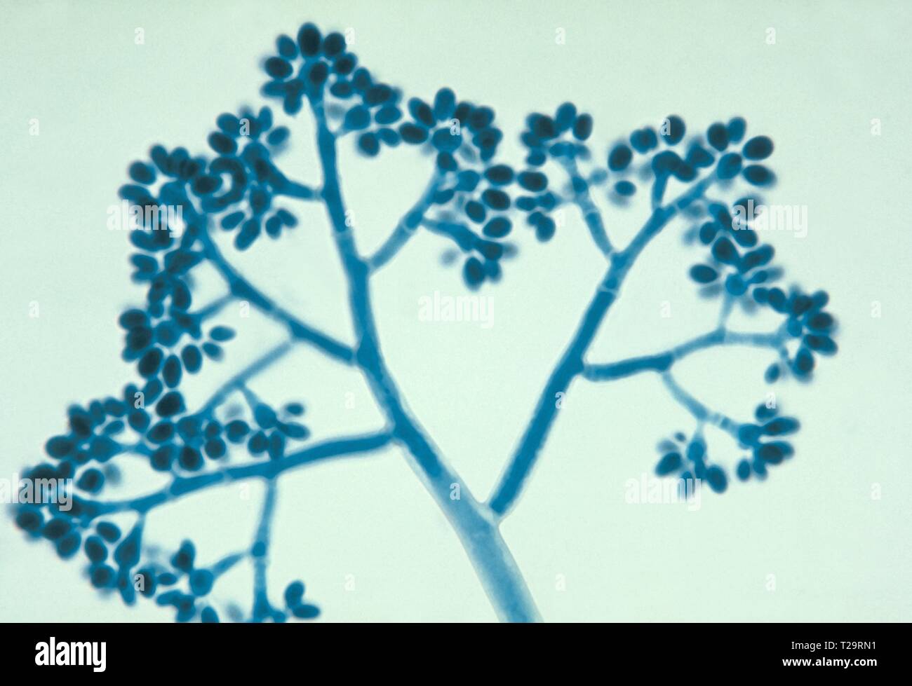 Photomicrograph eines Botrytis Arten Pilze (Grauschimmel), Cluster von Asexuellen spore - mit Konidien, 1955. Bild mit freundlicher Genehmigung Zentren für Krankheitskontrolle und Prävention (CDC)/Dr Lucille K. Georg. () Stockfoto