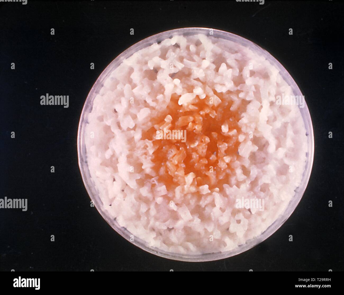 Nahaufnahme der agar Kultur Platte mit Microsporum audouinii Pilz, schlecht wachsen auf gekochte Reiskörner poliert, 1962. Bild mit freundlicher Genehmigung Zentren für Krankheitskontrolle und Prävention (CDC)/Dr Lucille K. George. () Stockfoto