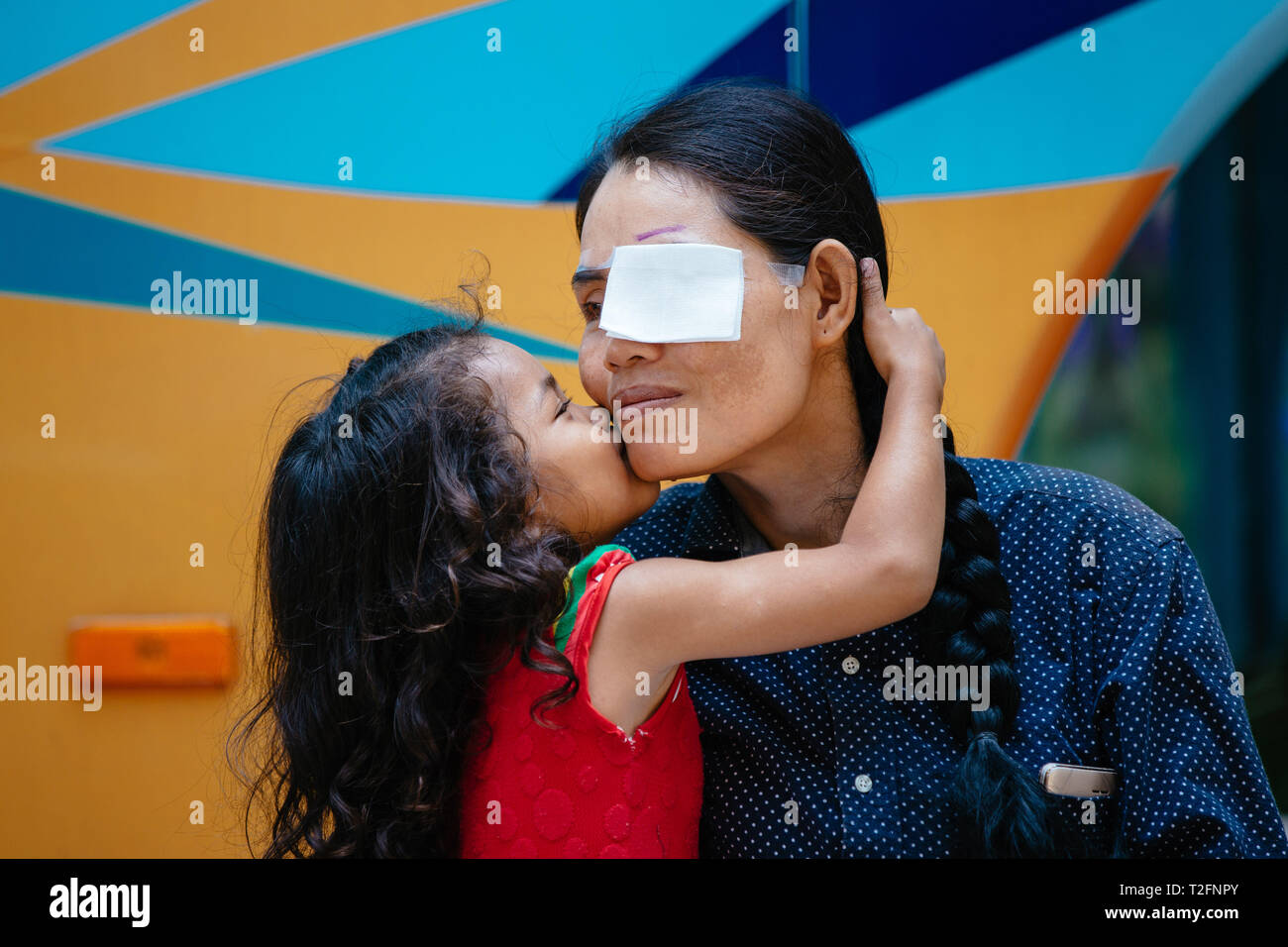 (190402) - PHNOM PENH, 2. April 2019 (Xinhua) - Summe Meyle erhält einen Kuss von ihrer Tochter vor einer Operation im Krankenhaus in der Provinz Kampong Cham Kampong Cham, Kambodscha, 15. März 2019. Summe Meyle, 36, ist alleinerziehende Mutter mit 5 Kindern. Um zu helfen, ihre finanziellen Bedingungen, zwei von meyle's Töchter jetzt Arbeiten in der Hauptstadt Phnom Penh, während zwei ihrer Söhne leben in einem Pflegeheim zu verbessern. Meyle lebt jetzt in einem gemieteten shanty Haus mit ihrer jüngsten Tochter. Meyle von Katarakt erlitten, nachdem ihr linkes Auge verletzt wurde. Vor sieben Monaten hatte sie fast Stockfoto