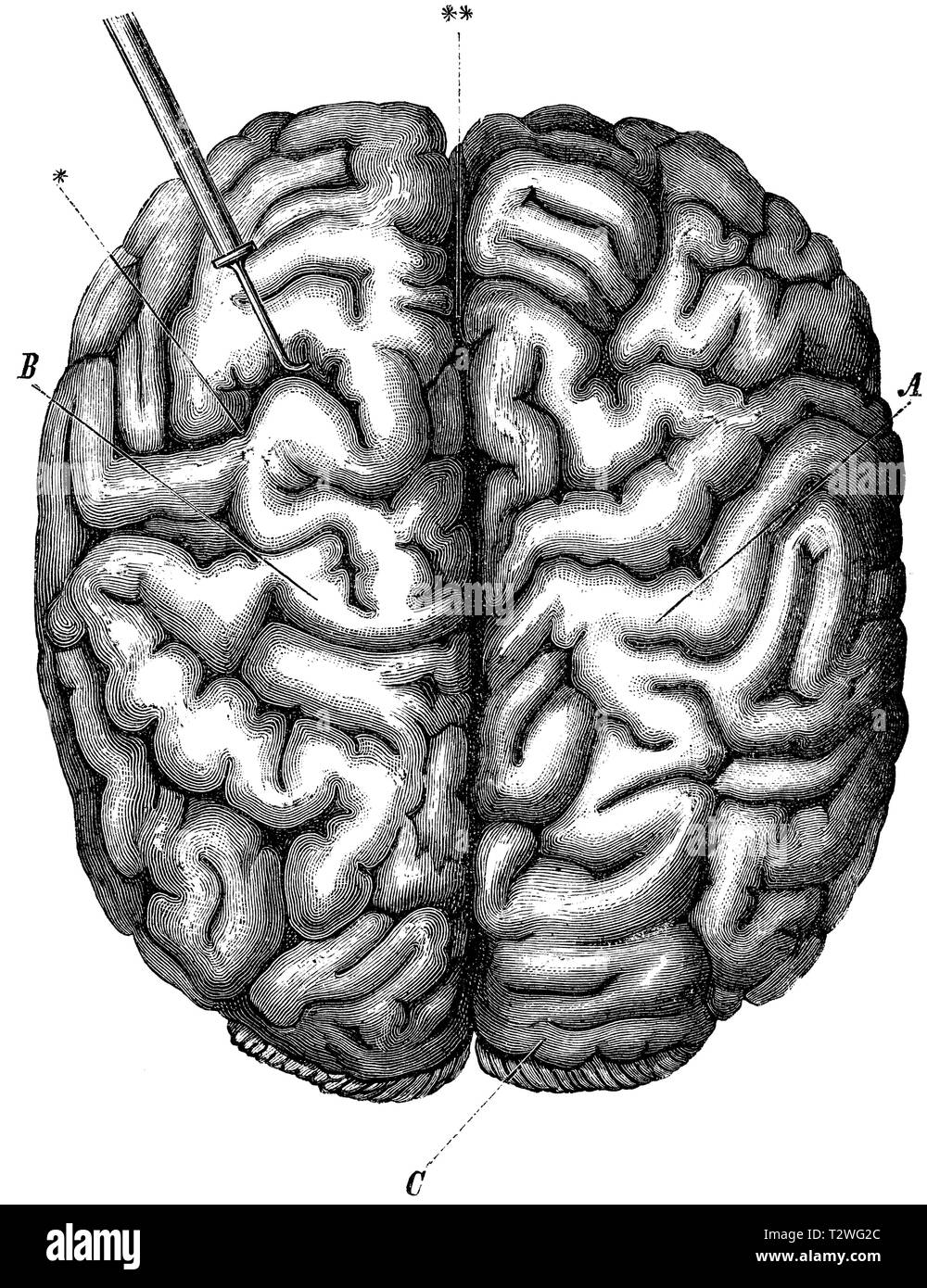 Das Gehirn des Menschen. A, B) der zerebralen Hemisphären, C) kleines Gehirn, * ein Home-Becken- Furche, *** Große mittlere Furche, anonym 1887 Stockfoto
