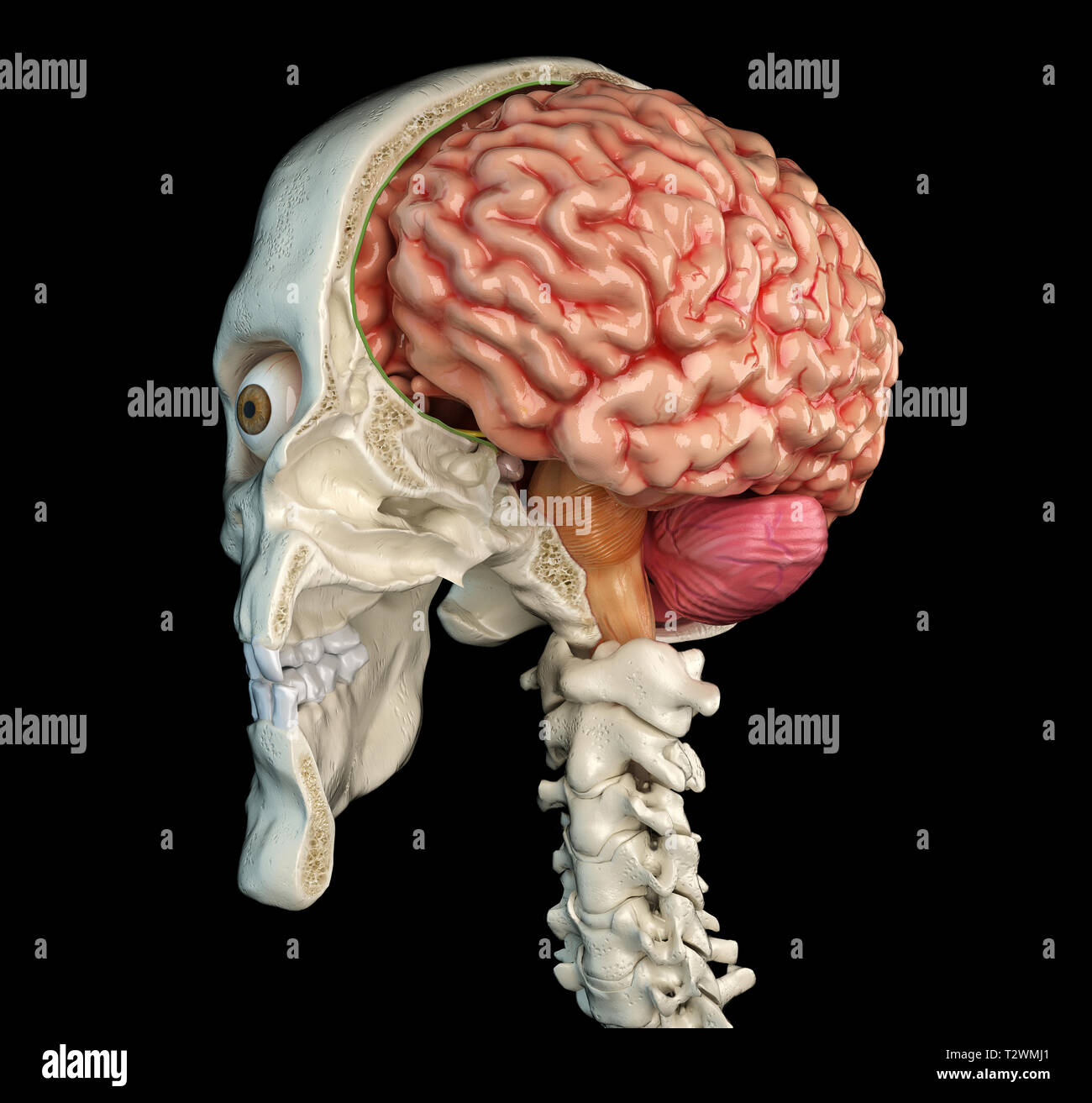 Menschlicher Schädel mittlere sagittale Querschnitt mit Gehirn. Perspektivische Ansicht auf schwarzem Hintergrund. Stockfoto