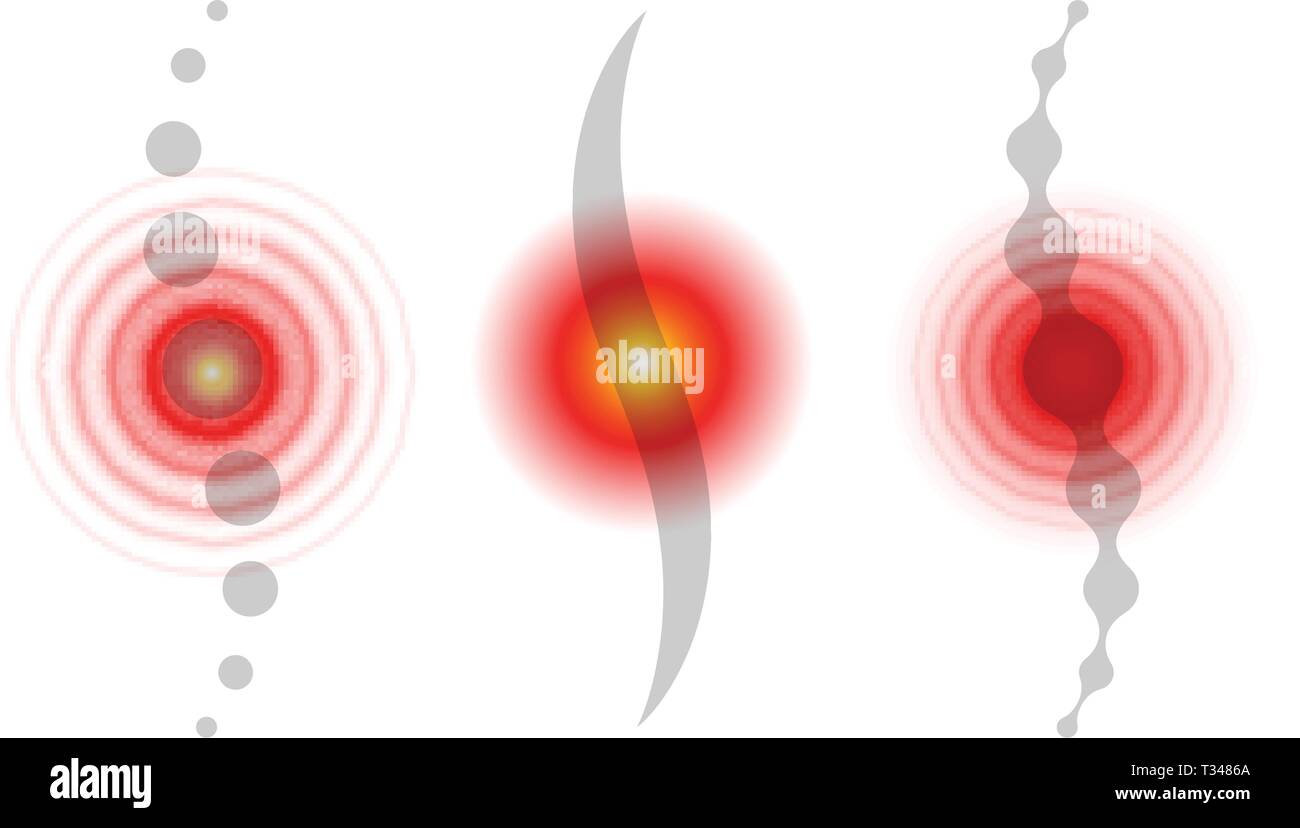 Schmerzen im Bereich der Wirbelsäule. Rückenschmerzen abstract Vector Icons. Medizinische Infografik Elemente. Vector Illustration. Stock Vektor