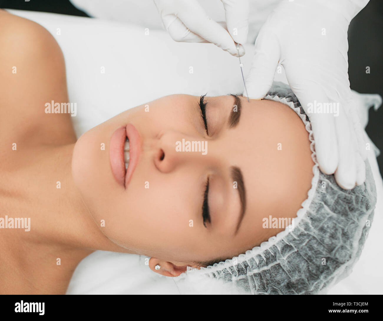 Kosmetikerin installiert Die mesothreads in das Gesicht der Frau. Anti-aging kosmetische Verfahren Stockfoto