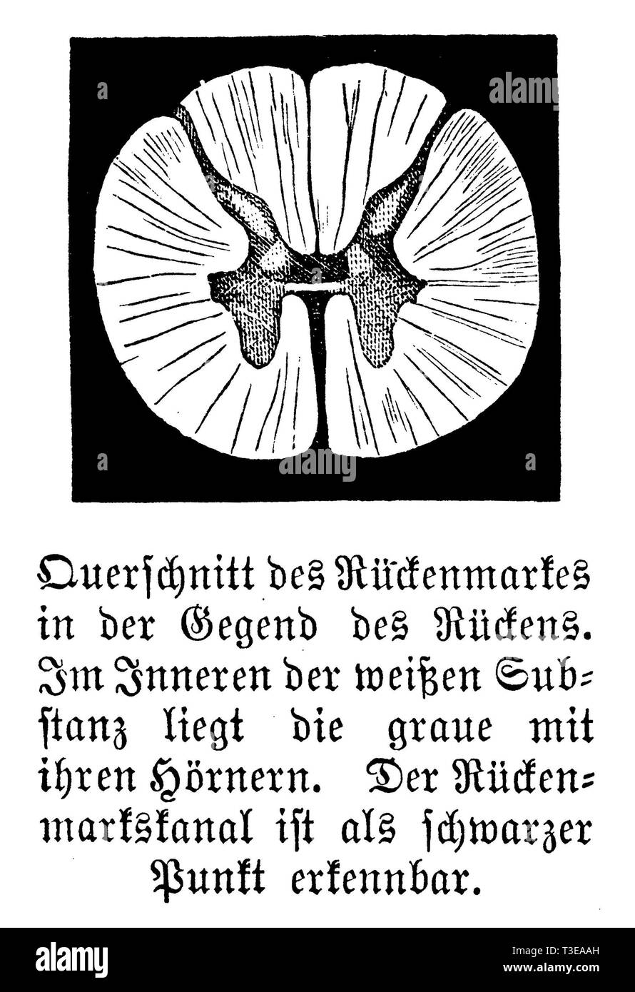 Mensch: Querschnitt des Rückenmarks in der Region den Rücken. Innerhalb der weißen Substanz liegt die Graue mit den Hörnern. Den Wirbelkanal ist erkennbar wie ein schwarzer Punkt., anonym Stockfoto