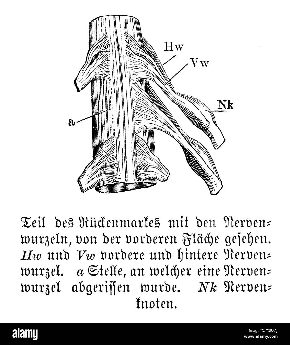 Mensch: Teil des Rückenmarks und der Nervenwurzeln aus dem vorderen Oberfläche gesehen. Hw) und Vw) anterioren und posterioren Nervenwurzeln. a) Stelle, wo eine Nervenwurzel abgerissen wurde. Nk) Nervenknoten, anonym Stockfoto