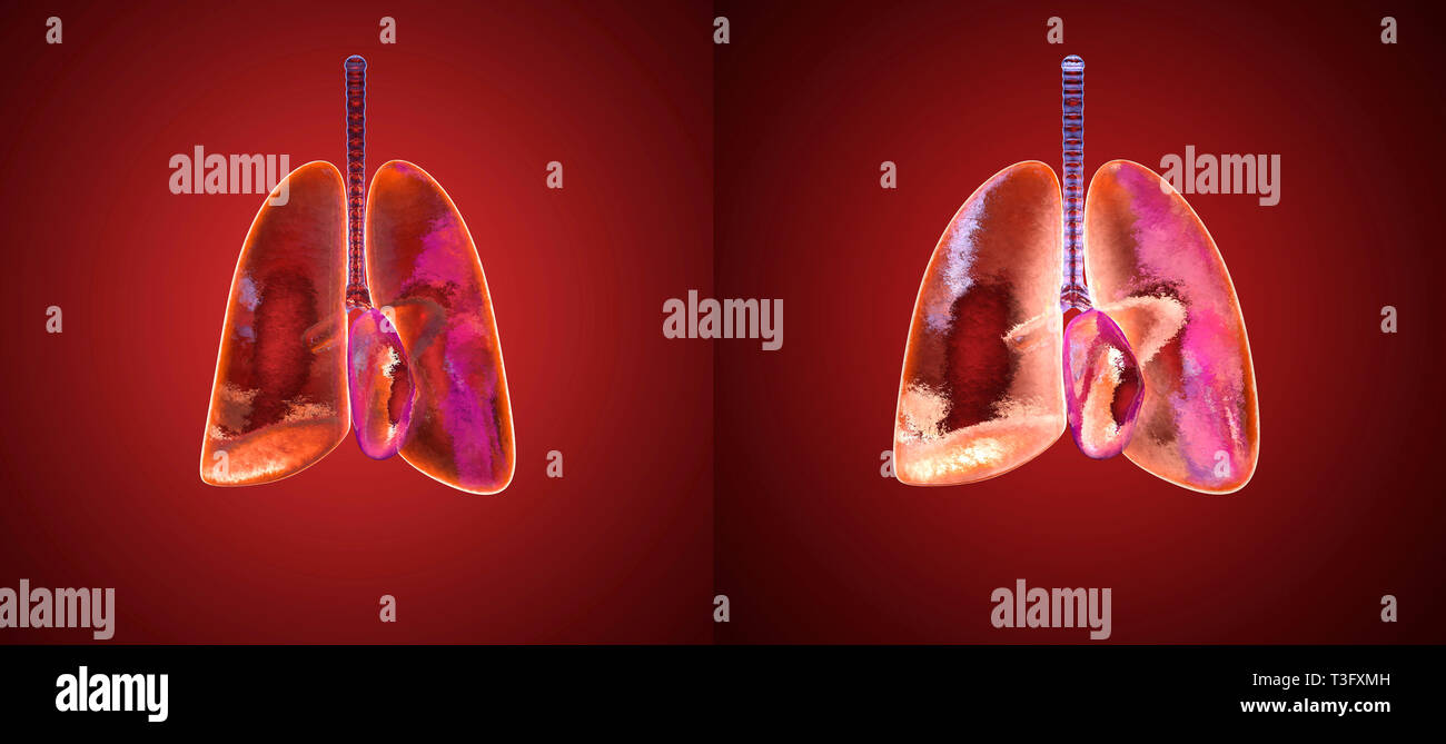 Examen pulmonar -Fotos und -Bildmaterial in hoher Auflösung – Alamy