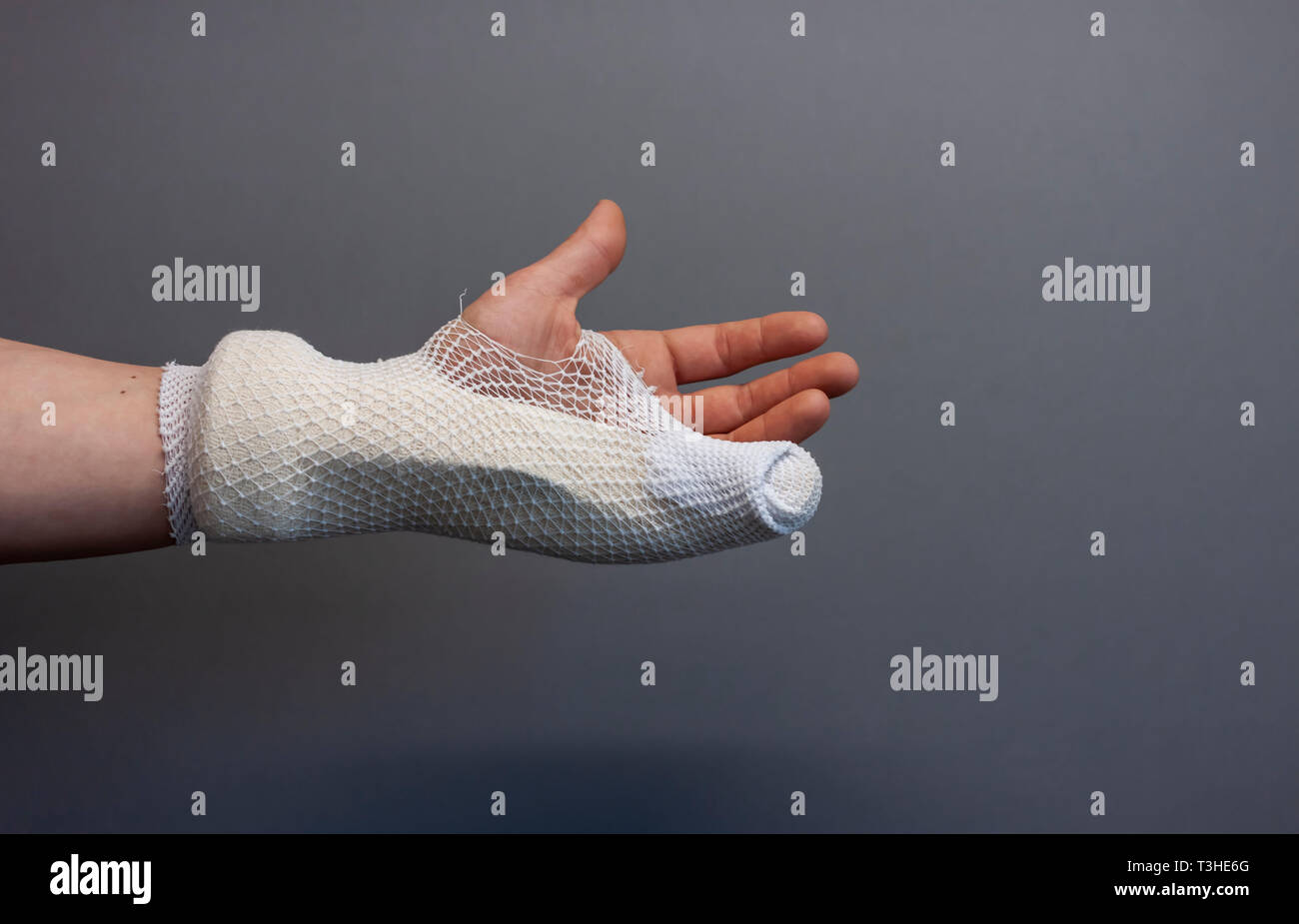 Gips medizinisch Fotos und Bildmaterial in hoher Auflösung Alamy