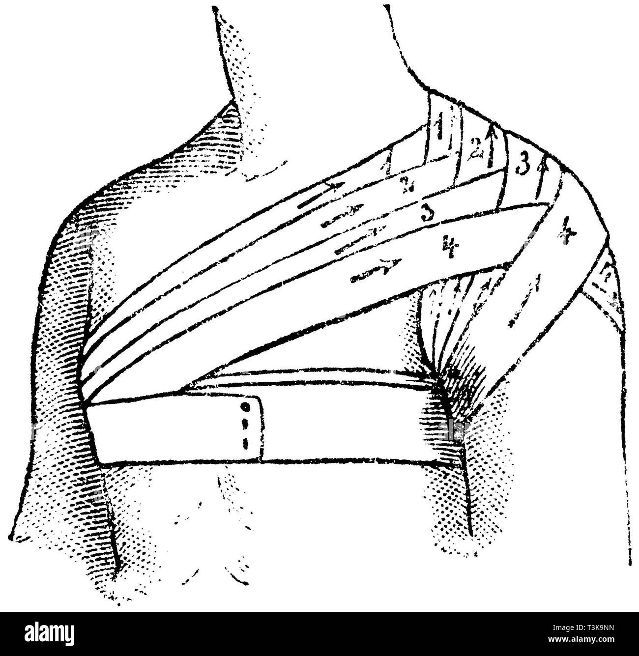 Shoulder bandage -Fotos und -Bildmaterial in hoher Auflösung – Alamy