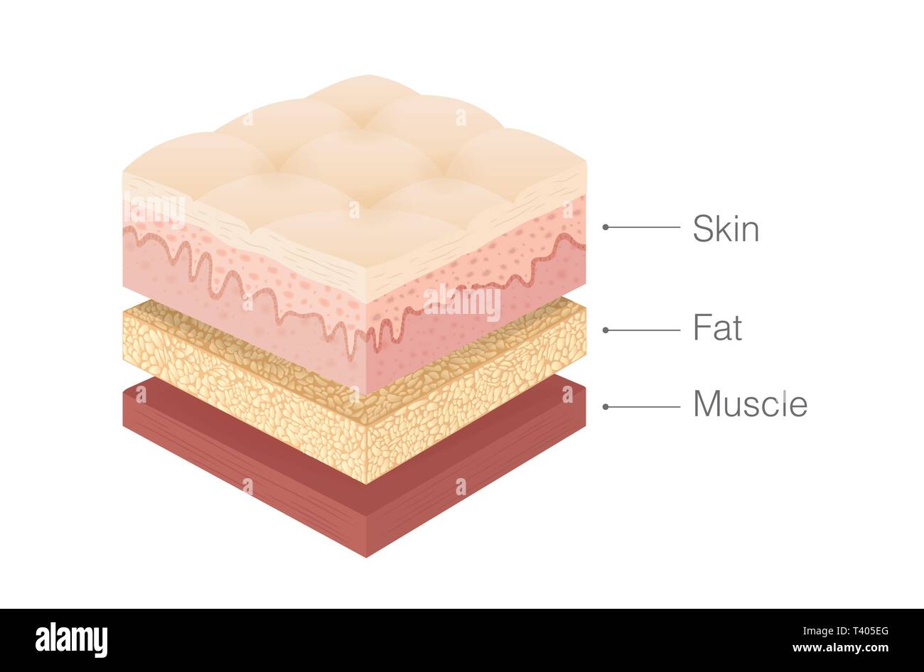 Anatomie der menschlichen Haut, Fett und Muskel Layer in isometrischer Stil. Stock Vektor